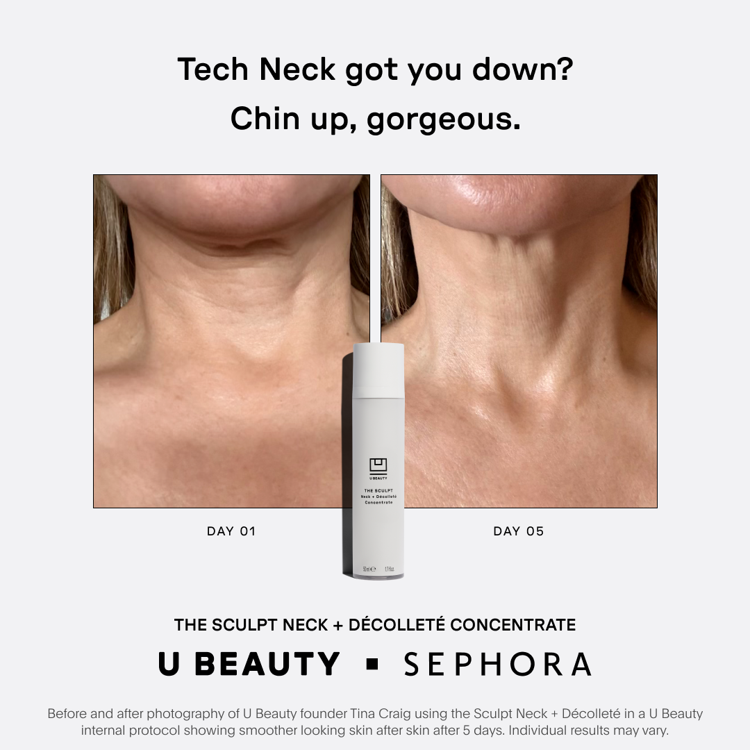 U Beauty Skincare Facebook ad from Mar 11, 2026
