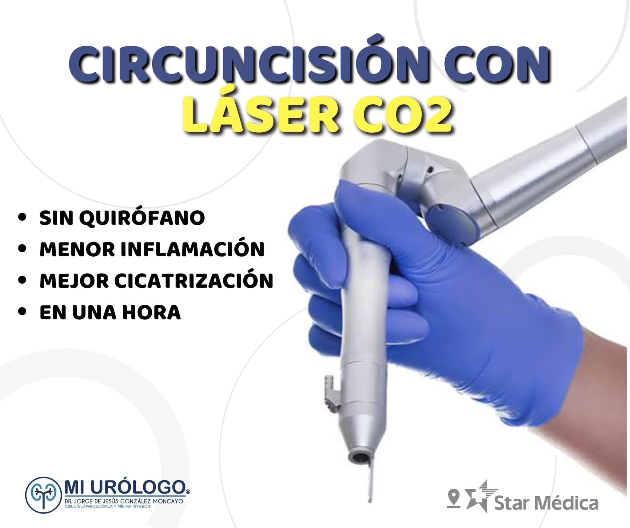 Urólogo en Chihuahua Dr. Jorge González Facebook ad: Circuncisión Láser CO2: SIN HOSPITALIZACIÓN