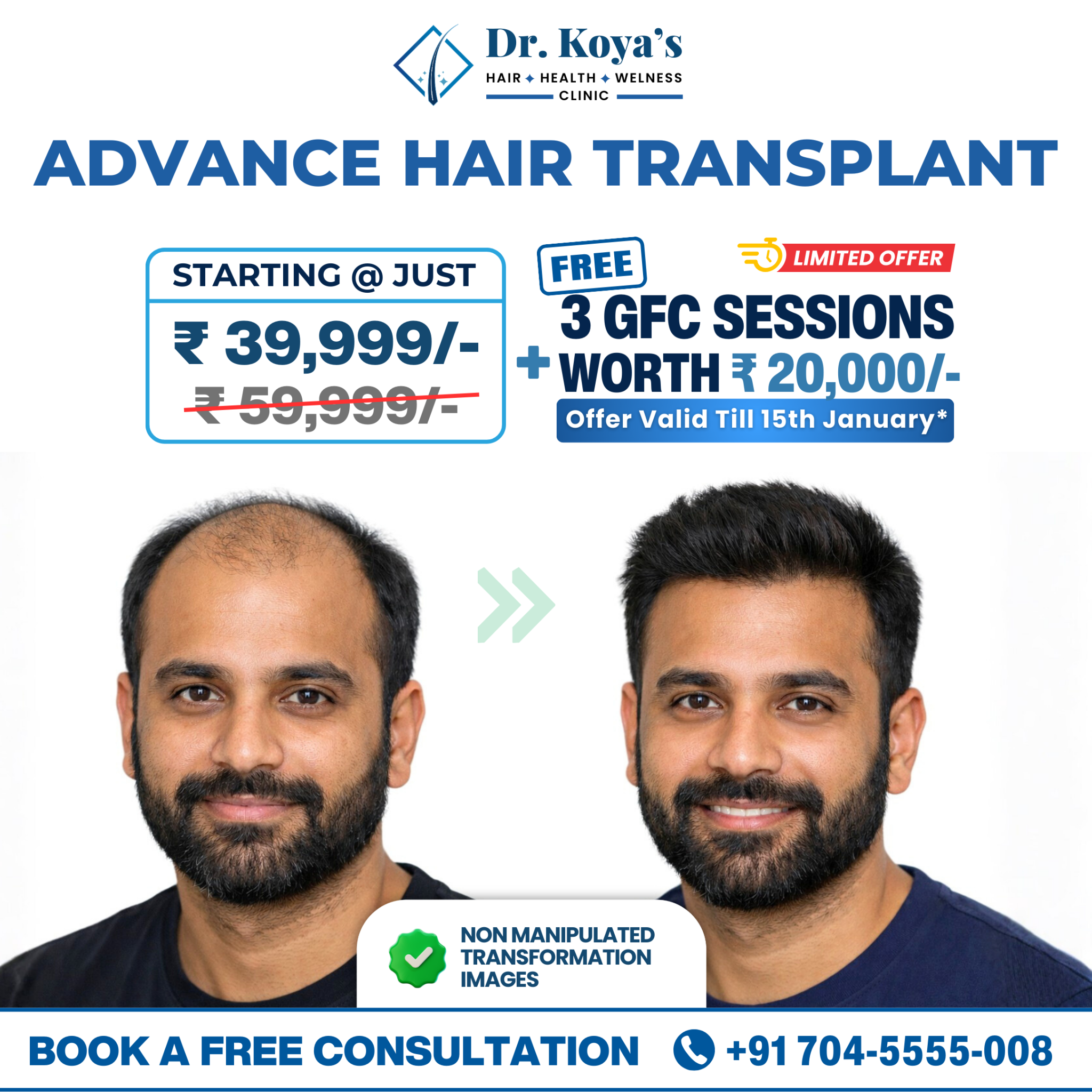 Dr. Koya's Hair Health & Wellness Centre Facebook ad: Get a FREE Hair Consultation