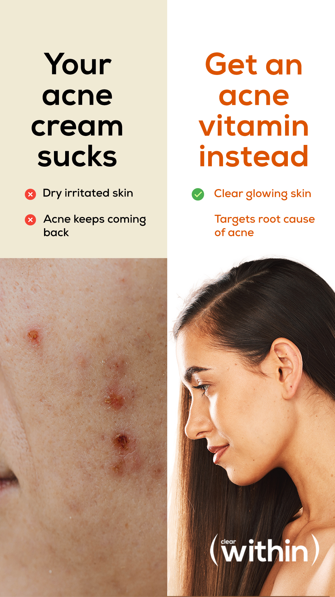 Within Skin Facebook ad