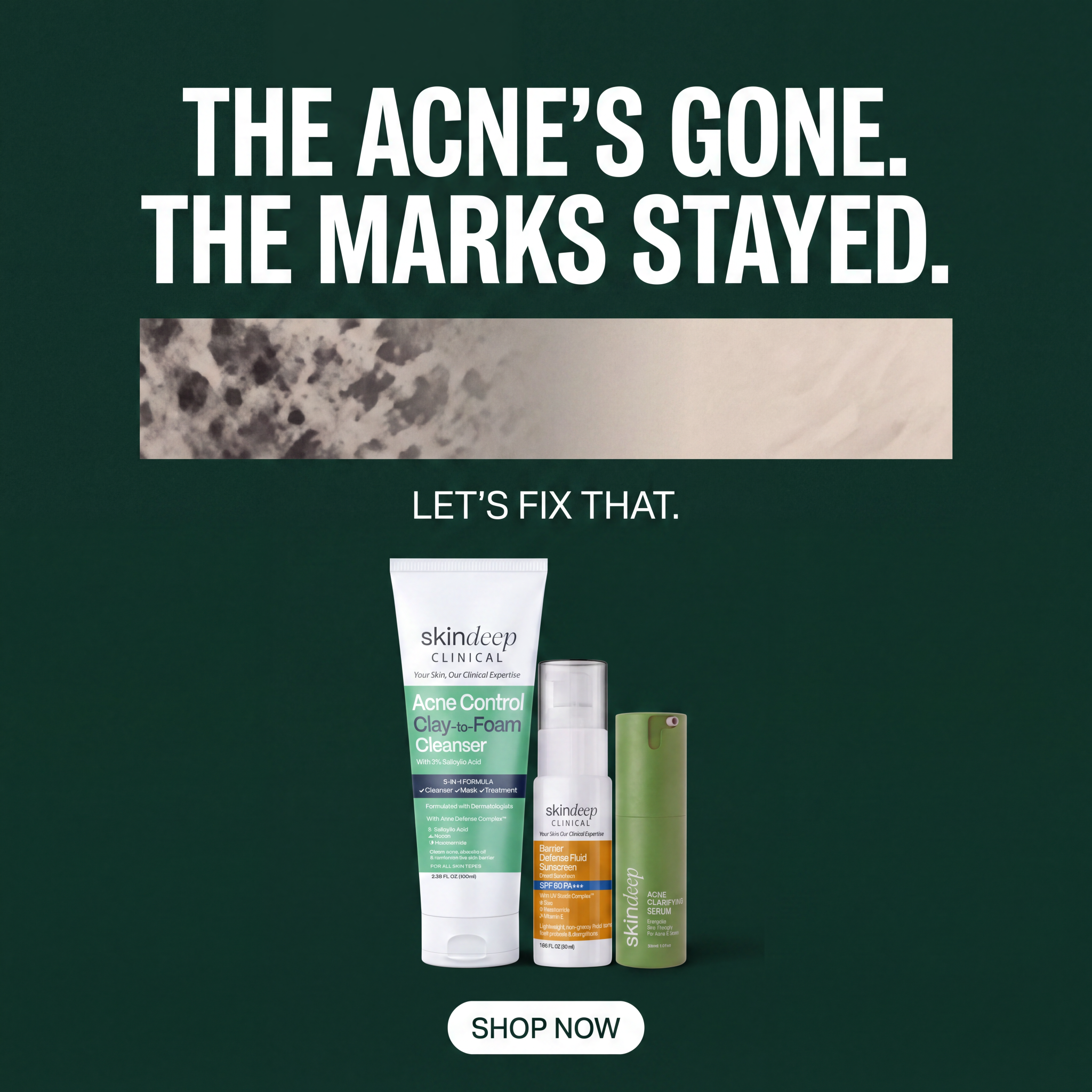 Skin Deep Facebook ad