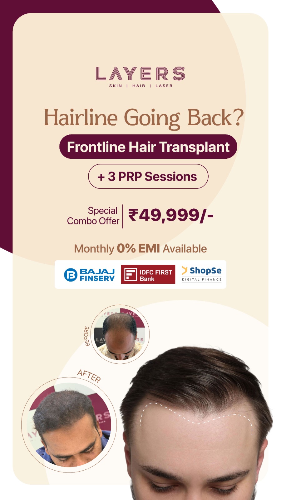 Layers Clinics - Skin & Hair Facebook ad