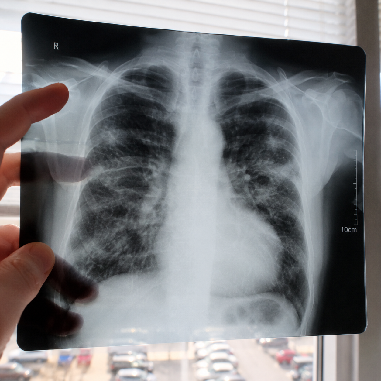 Lung Health Guide Facebook ad