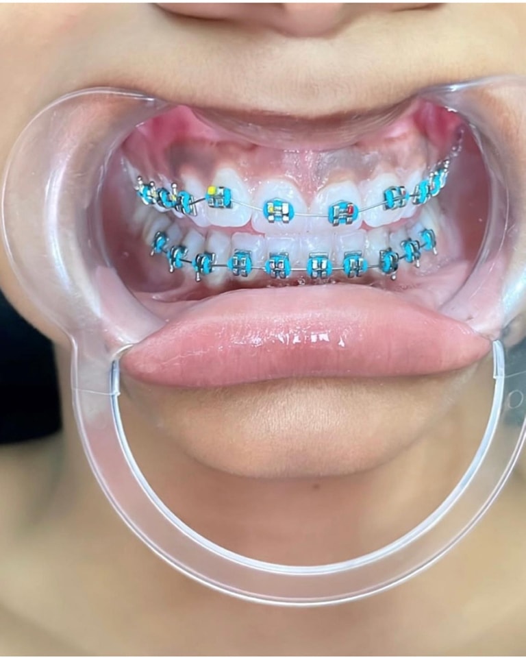 SMILE BEST Dental Clinic, Lagos Facebook ad