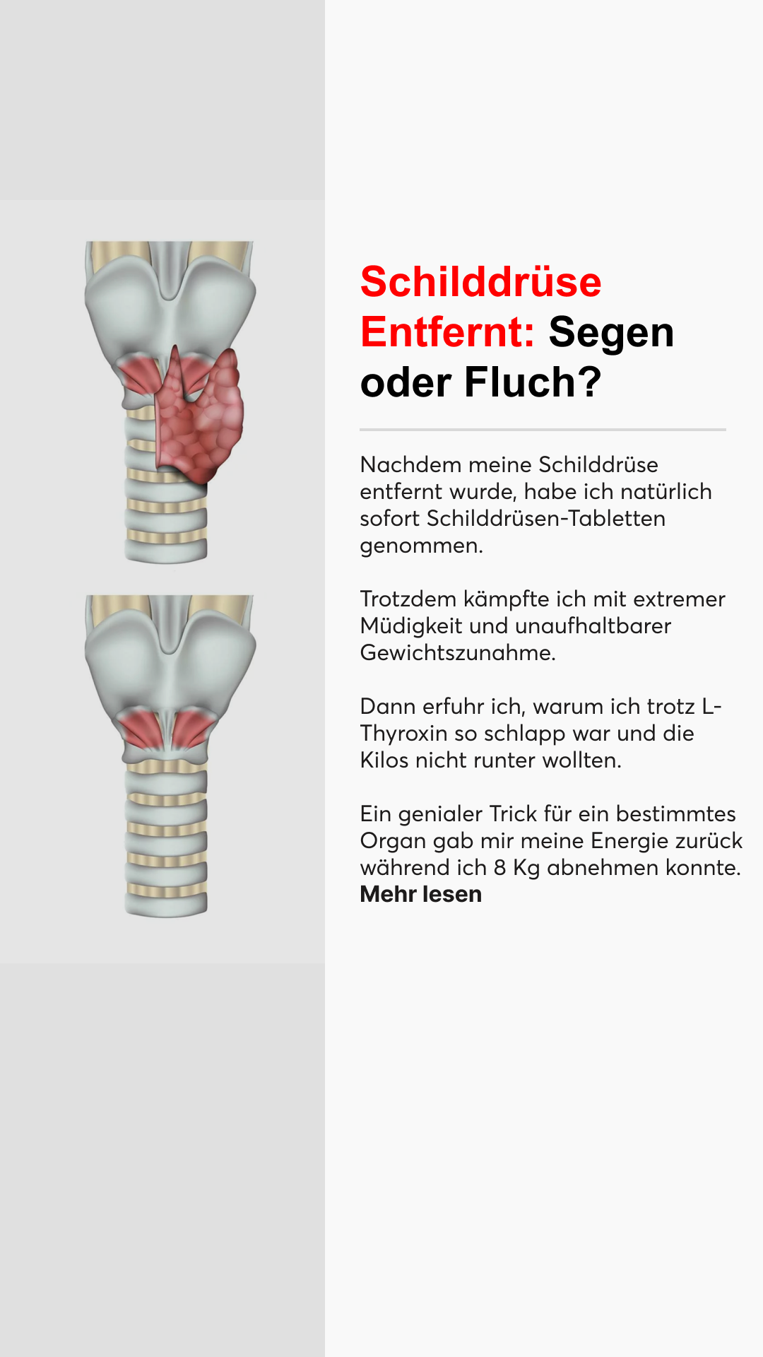 Mission Schilddrüse Facebook ad