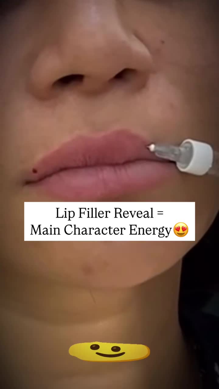 Dr Swati Mittal Facebook ad: Tired of Thin Lips? Here's the Glow-Up You Deserve!