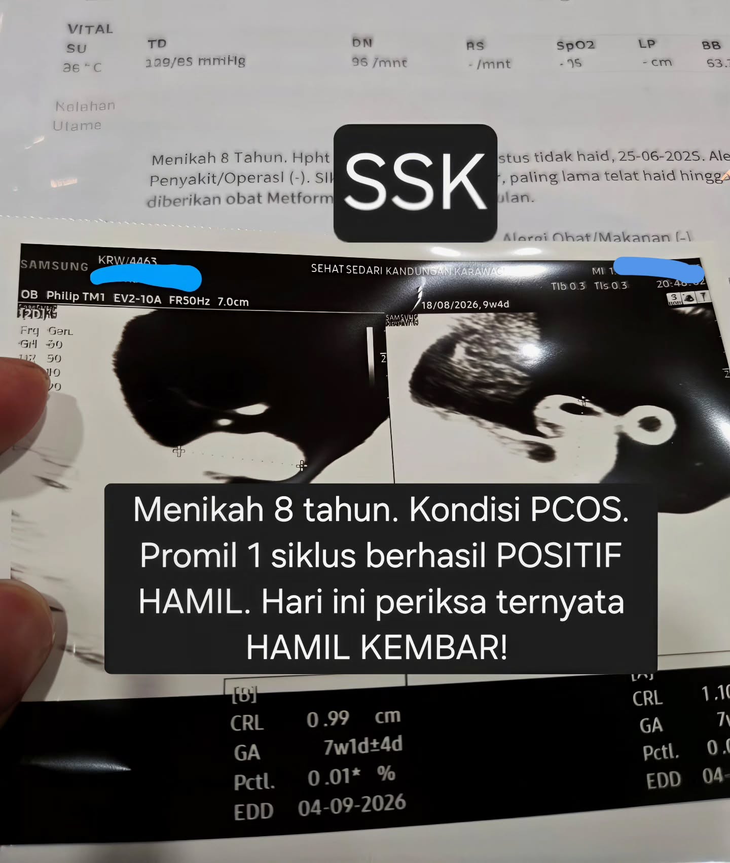 drphilipspog Facebook ad: MENIKAH 8 TAHUN DENGAN PCOS BERHASIL PROMIL