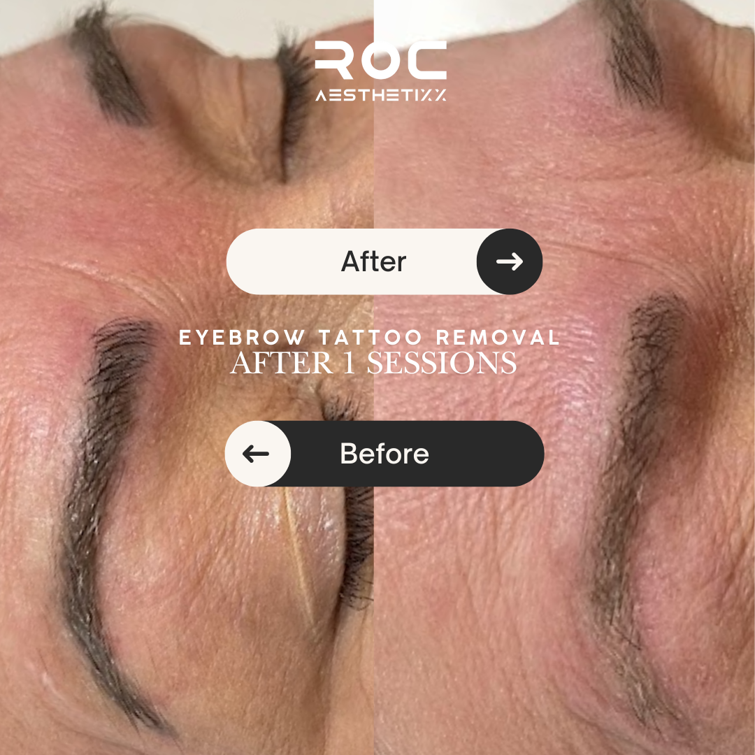 Roc Aesthetics Facebook ad