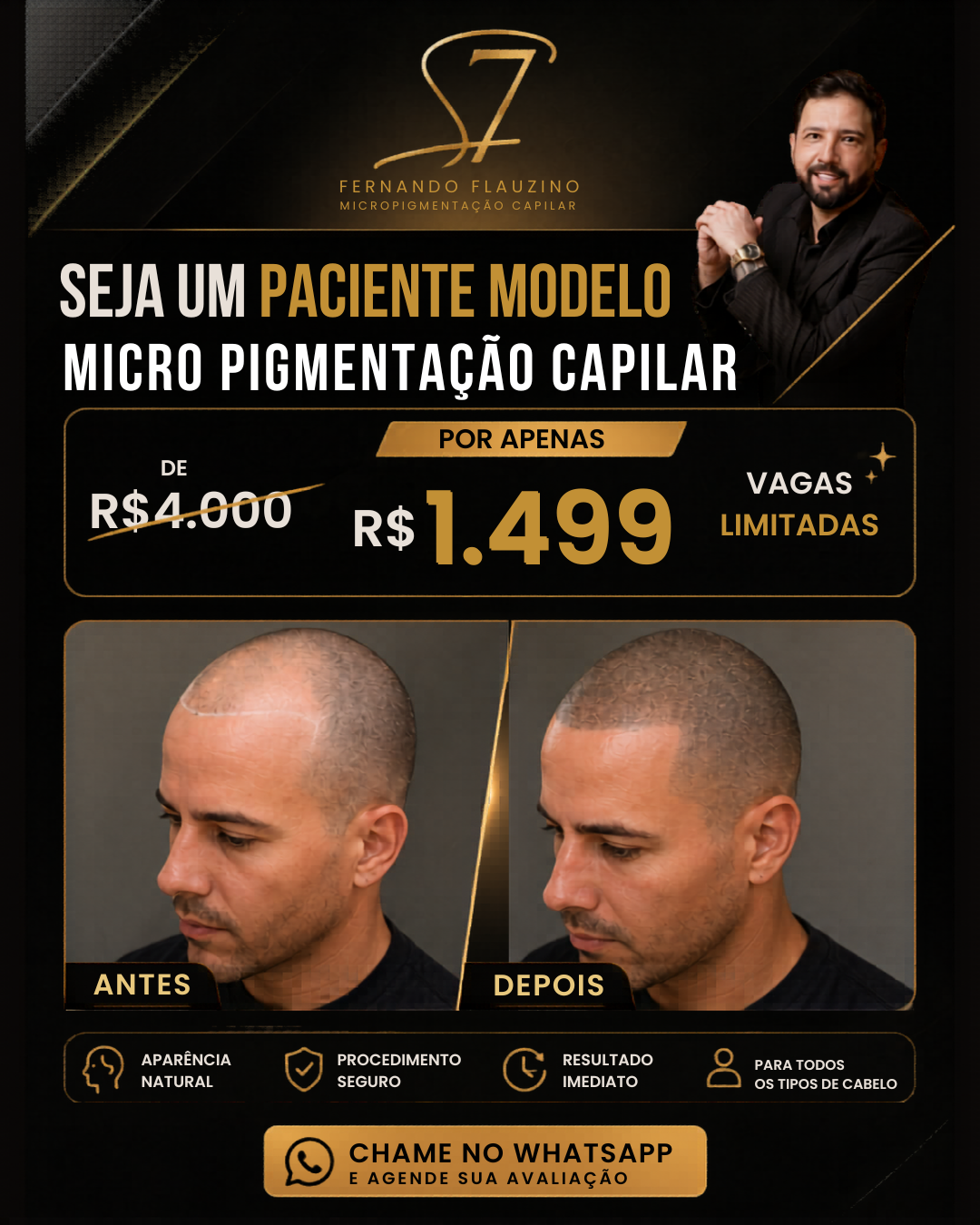 Fernando Flauzino Micropigmentação Capilar Avançada Facebook ad from May 9, 2026