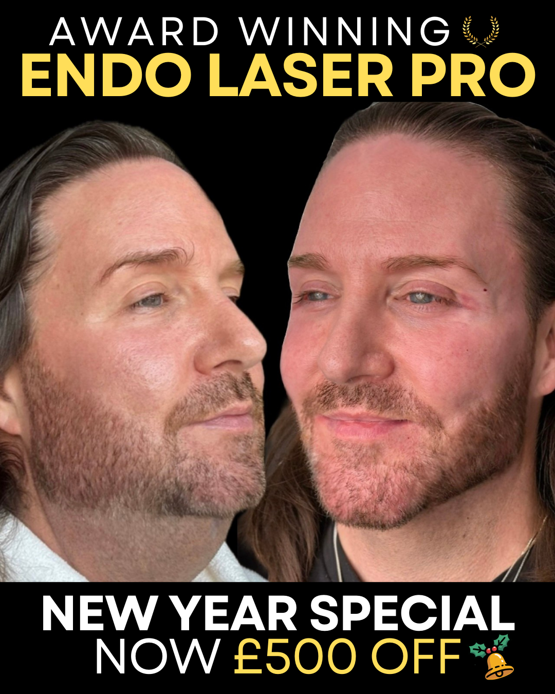 Aesthetics by KK Facebook ad from Mar 29, 2026