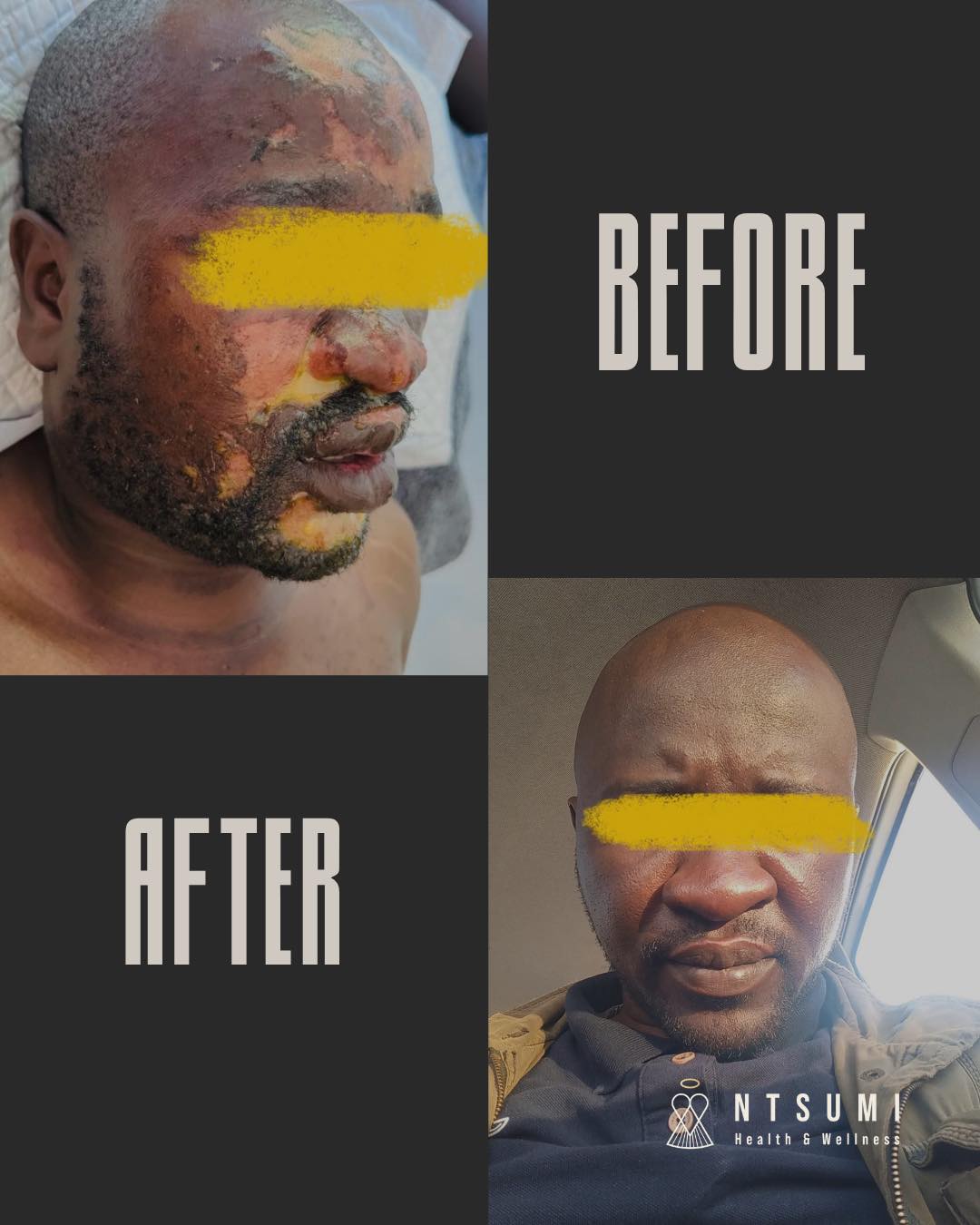 Ntsumi Health and Wellness Facebook ad: ACCELERATING HEALING AND RESTORING SKIN USING THE LIGHT…
