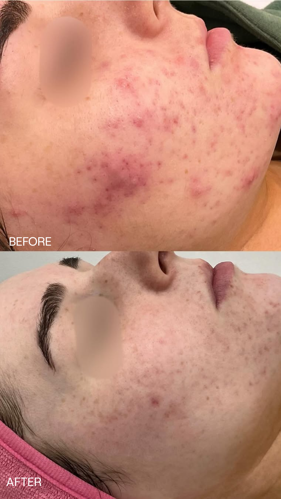 SILK Laser Clinics Facebook ad