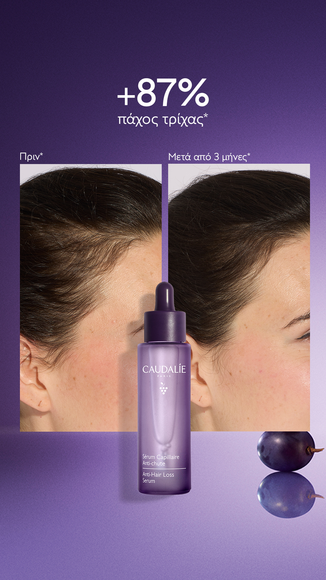 Caudalie Facebook ad: Νέο Anti-Hair Loss Serum