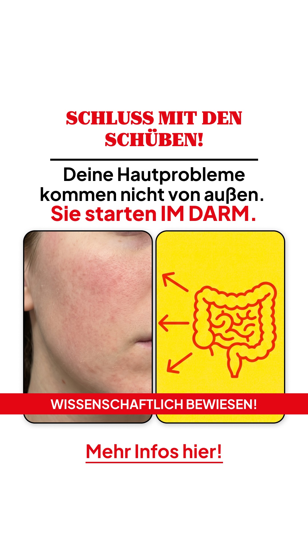Zentrum Darmgesundheit Facebook ad: SCHLUSS MIT DEN SCHÜBEN!
