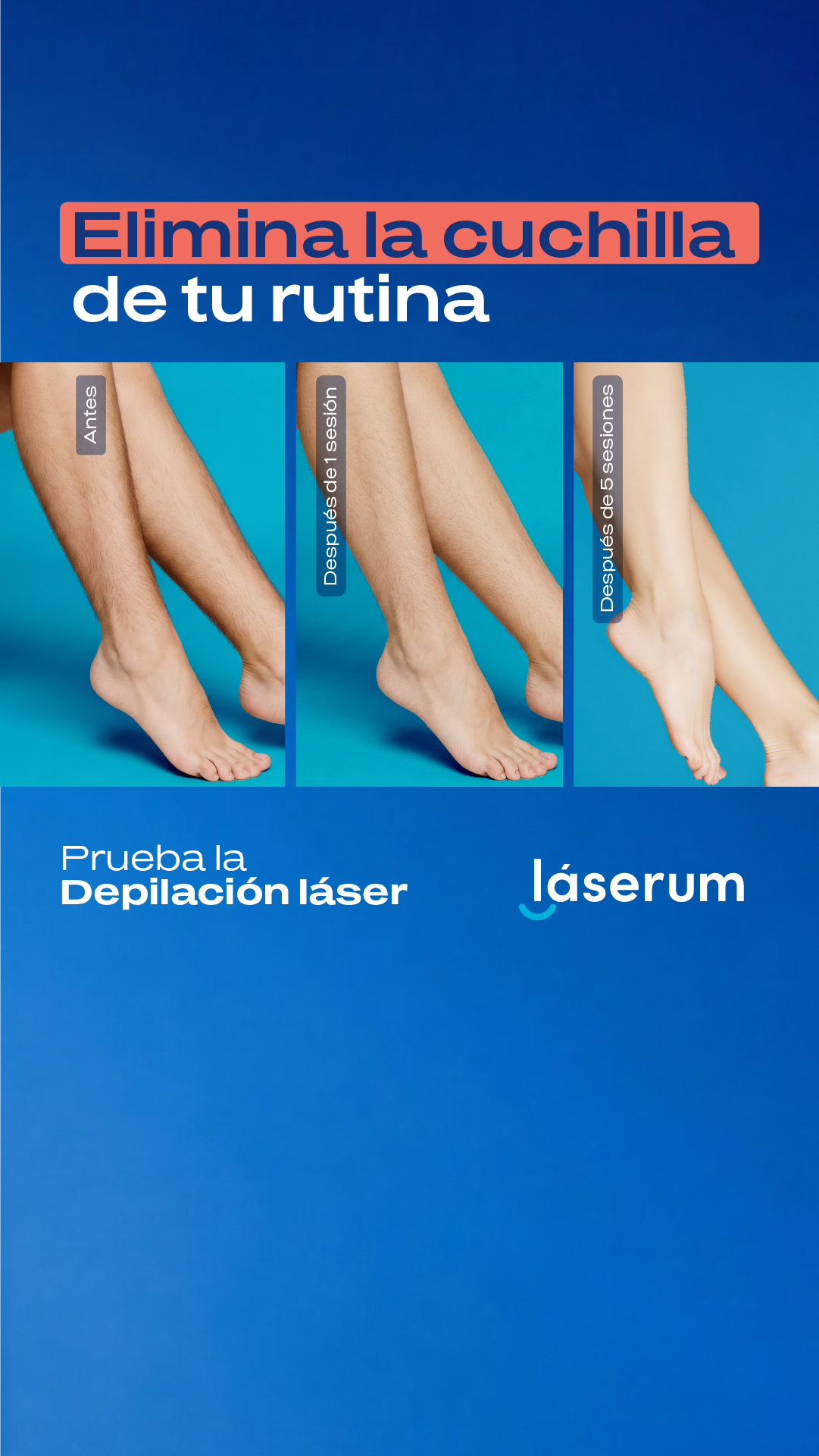 Láserum Facebook ad