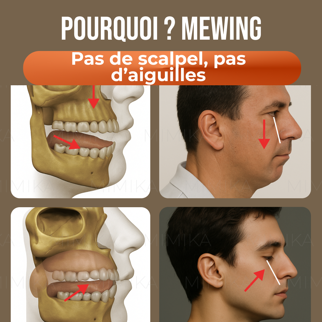 Mark Mewing Facebook ad
