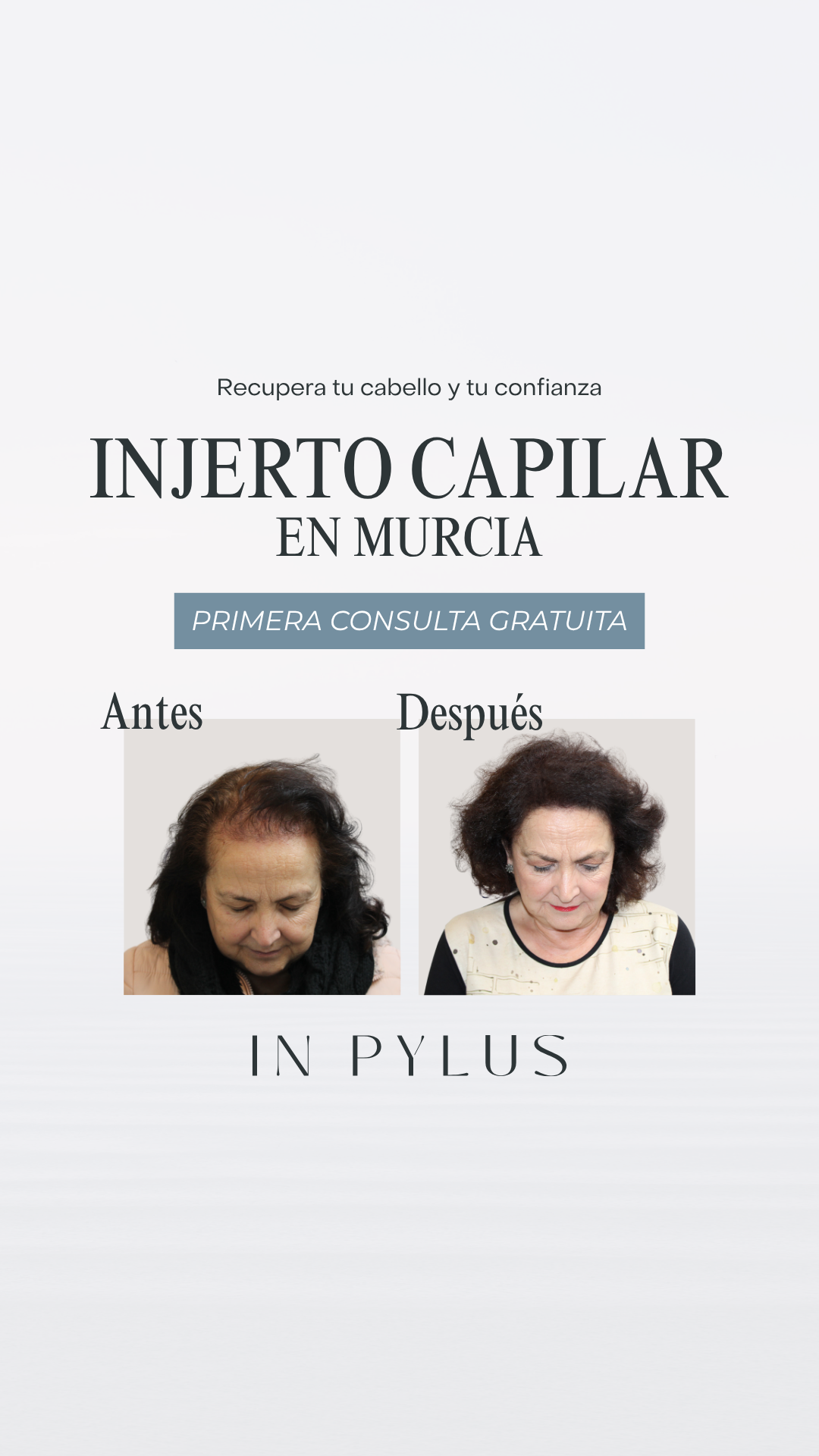 Clínica Inpylus - Trasplante Capilar Facebook ad