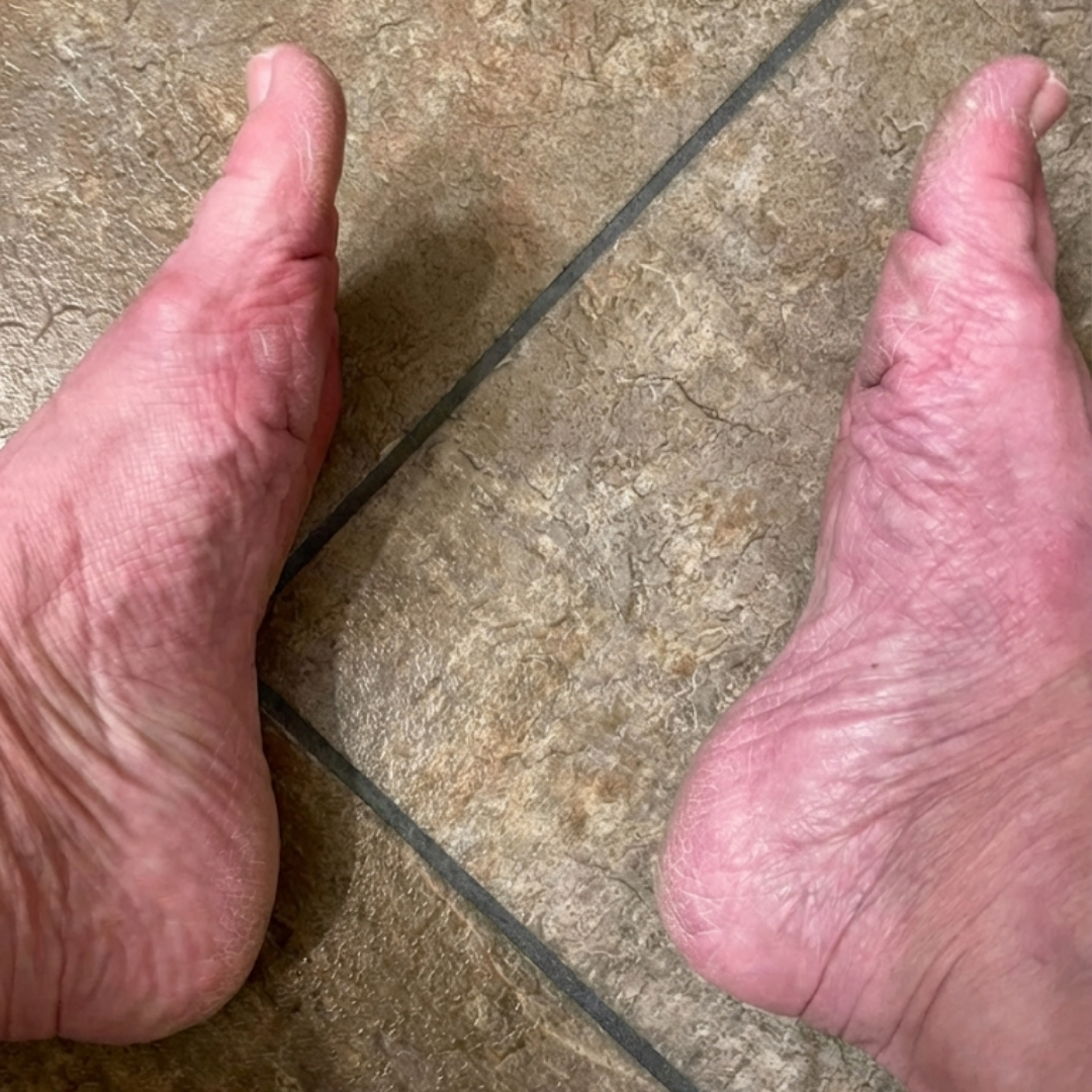 Neuropathy Care Tips Facebook ad