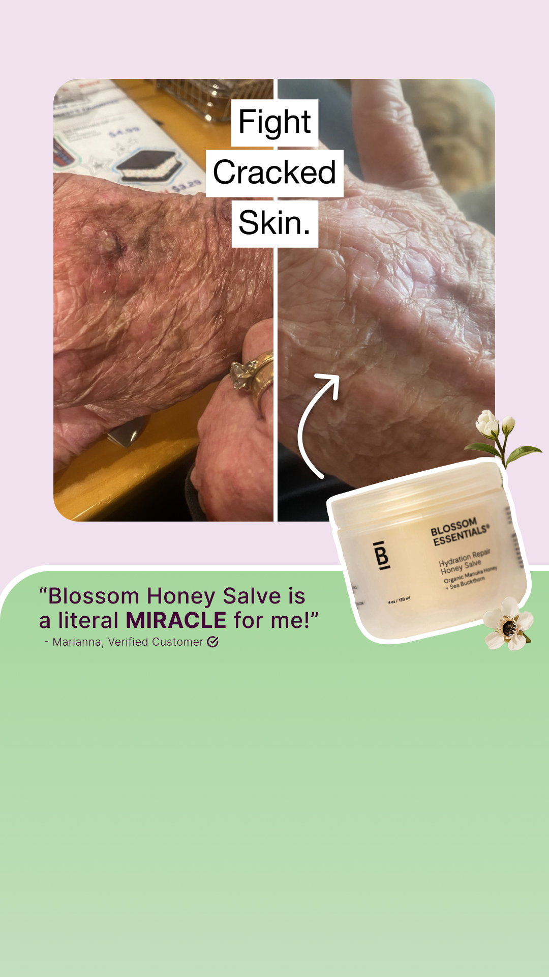 Blossom Essentials Skin Facebook ad