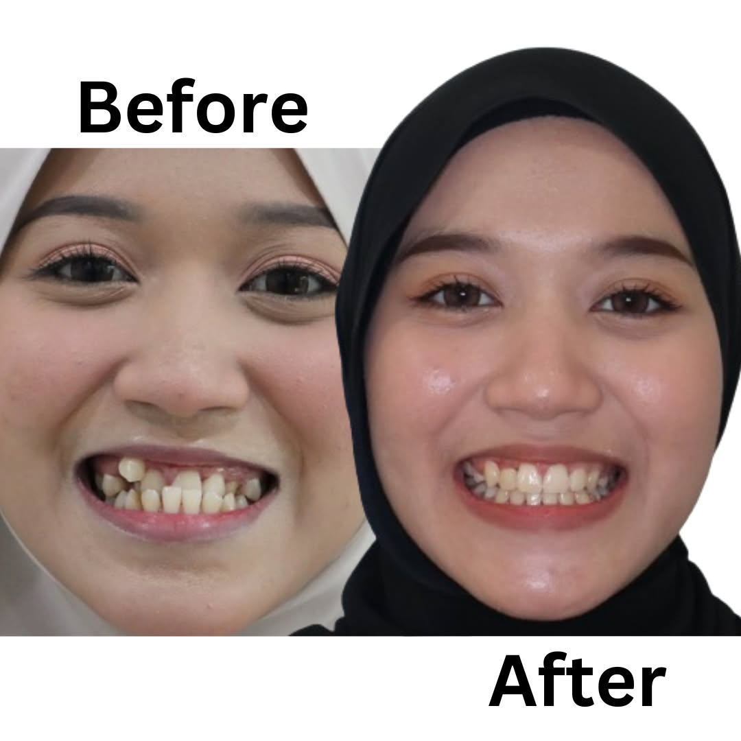 Klinik Pergigian Dr Smile Taman Equine Facebook ad