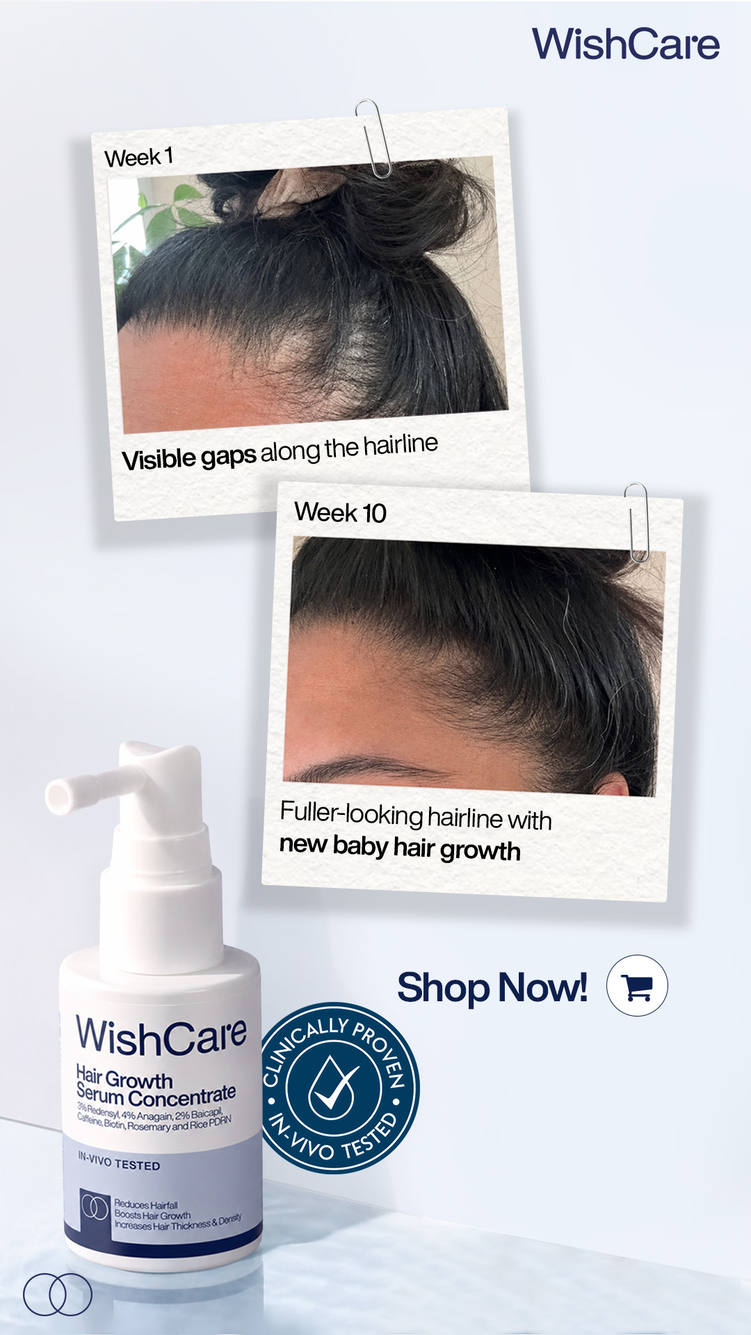 WishCare Facebook ad