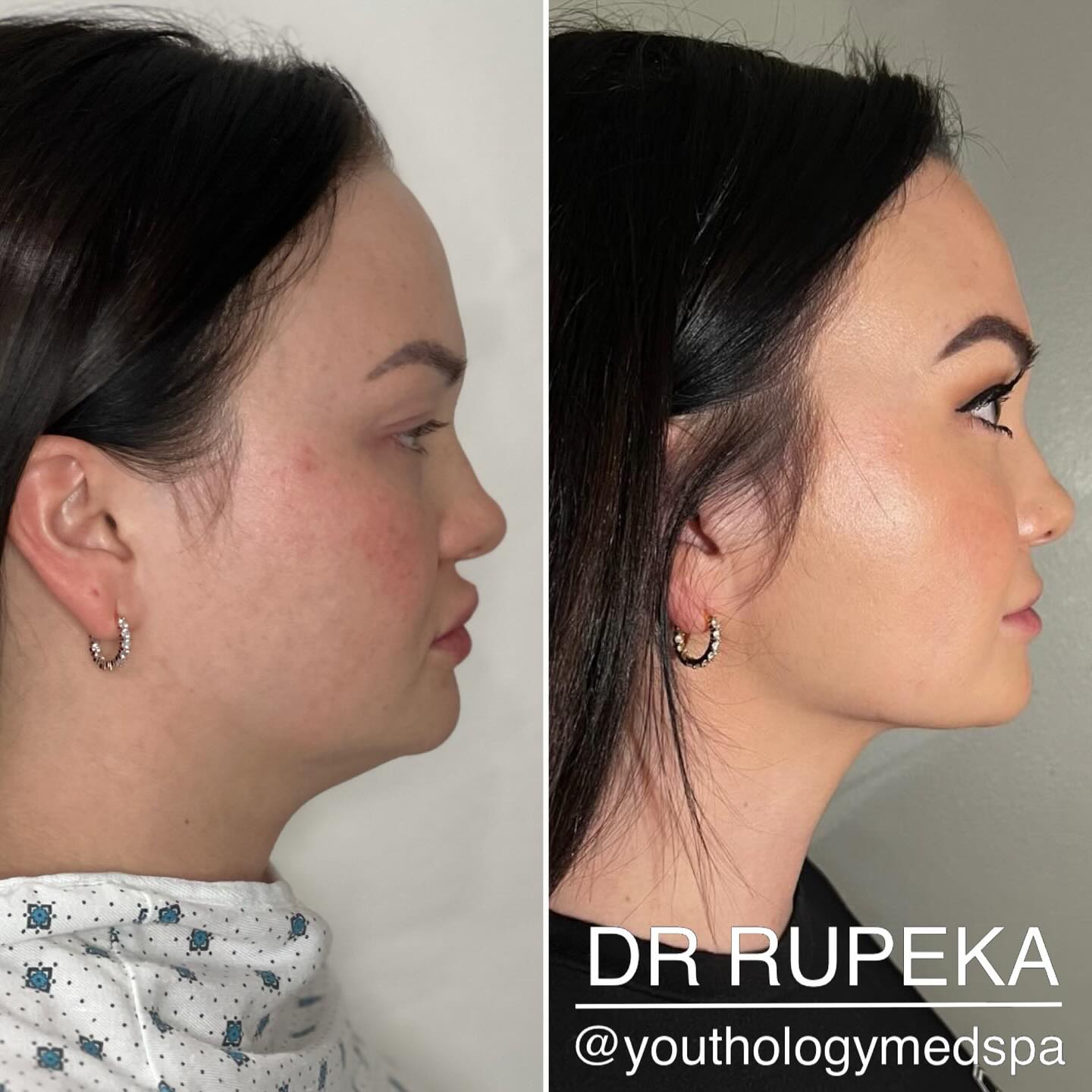 Youthology Medspa Facebook ad