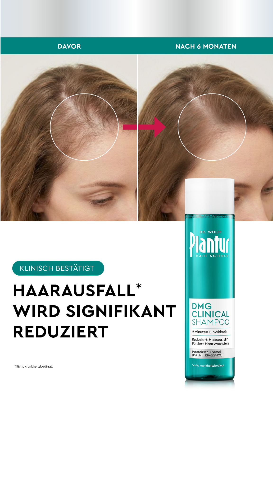 Plantur 39 Facebook ad