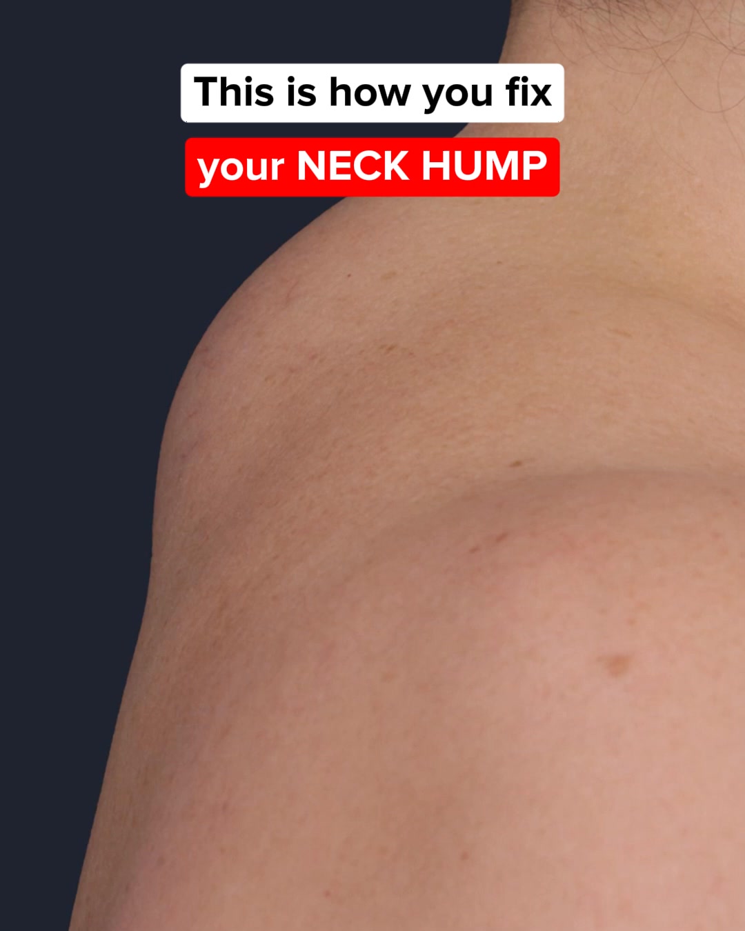 CALLIXE Facebook ad: No More Neck Hump | 1000+ Happy Sleepers