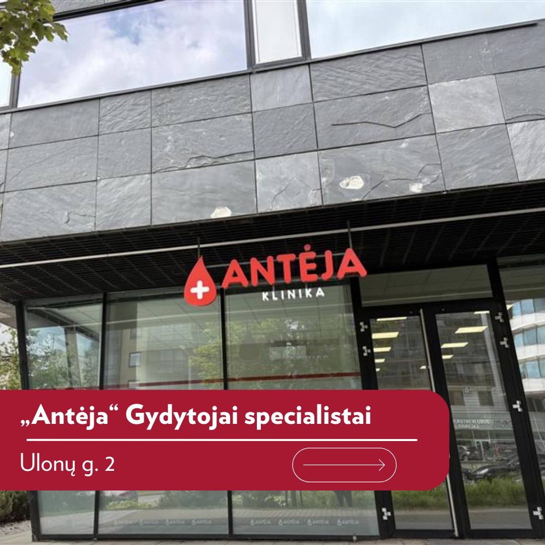 Antėja Facebook ad