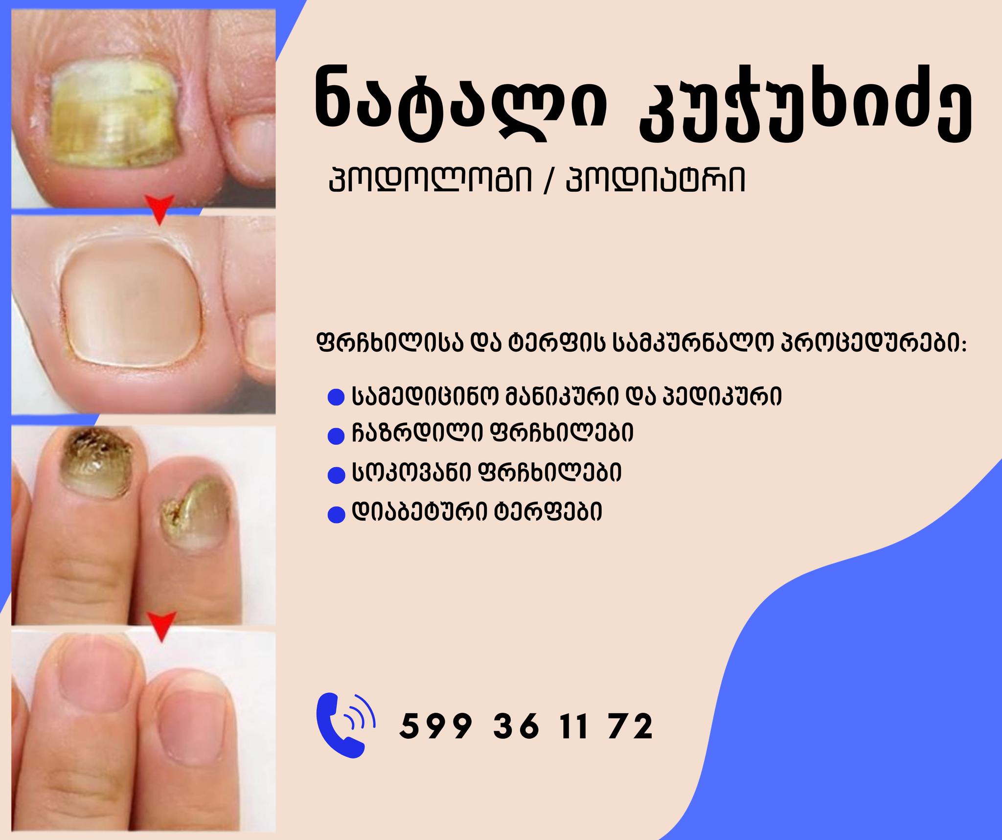პოდოლოგი-ნატალი კუჭუხიძე Facebook ad: დაიბრუნეთ თქვენი ჯანმრთელობა და სილამაზე!