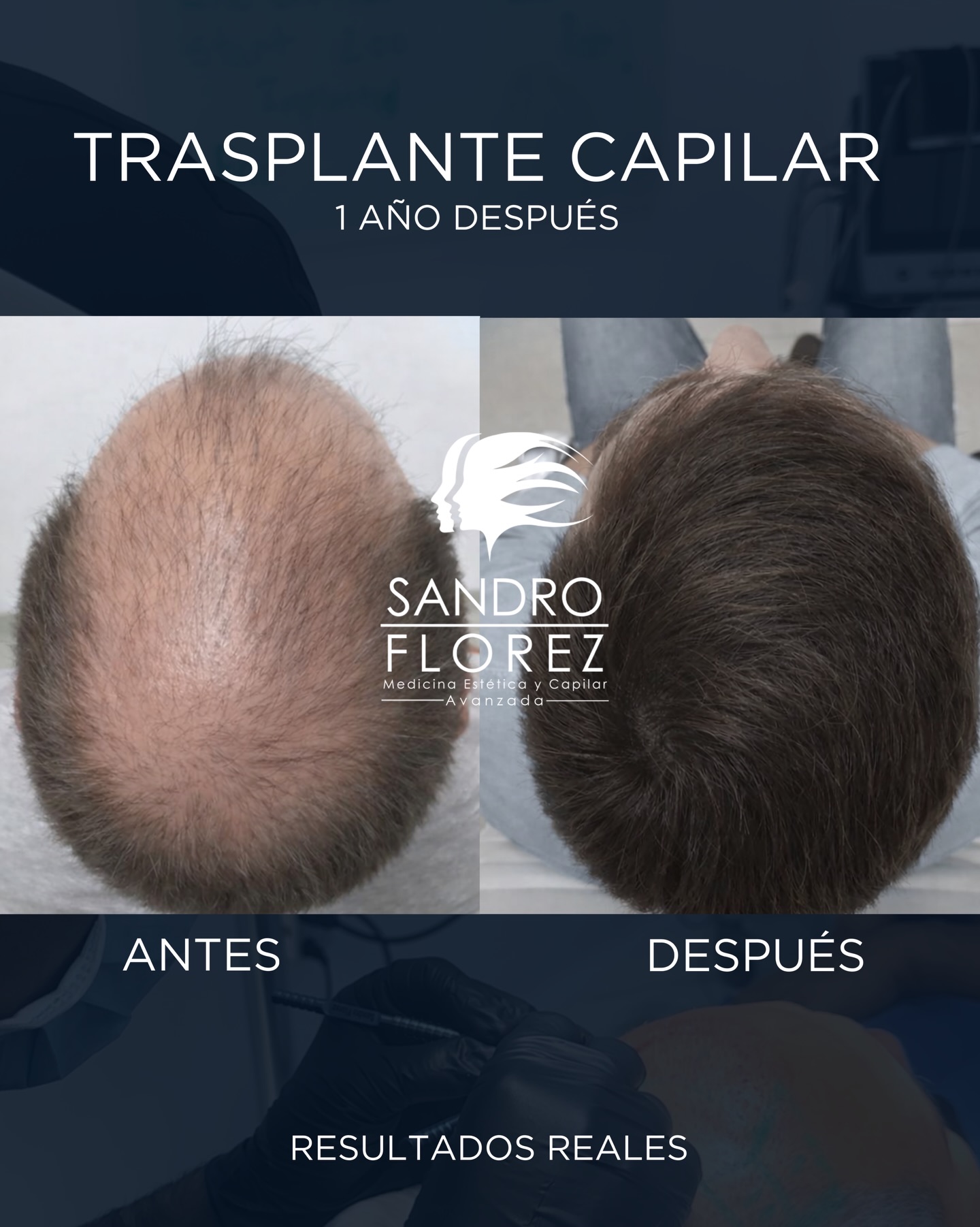 Dr. Sandro Florez Facebook ad: Estamos en Bogotá Resultados efectivos y duraderos, agenda…