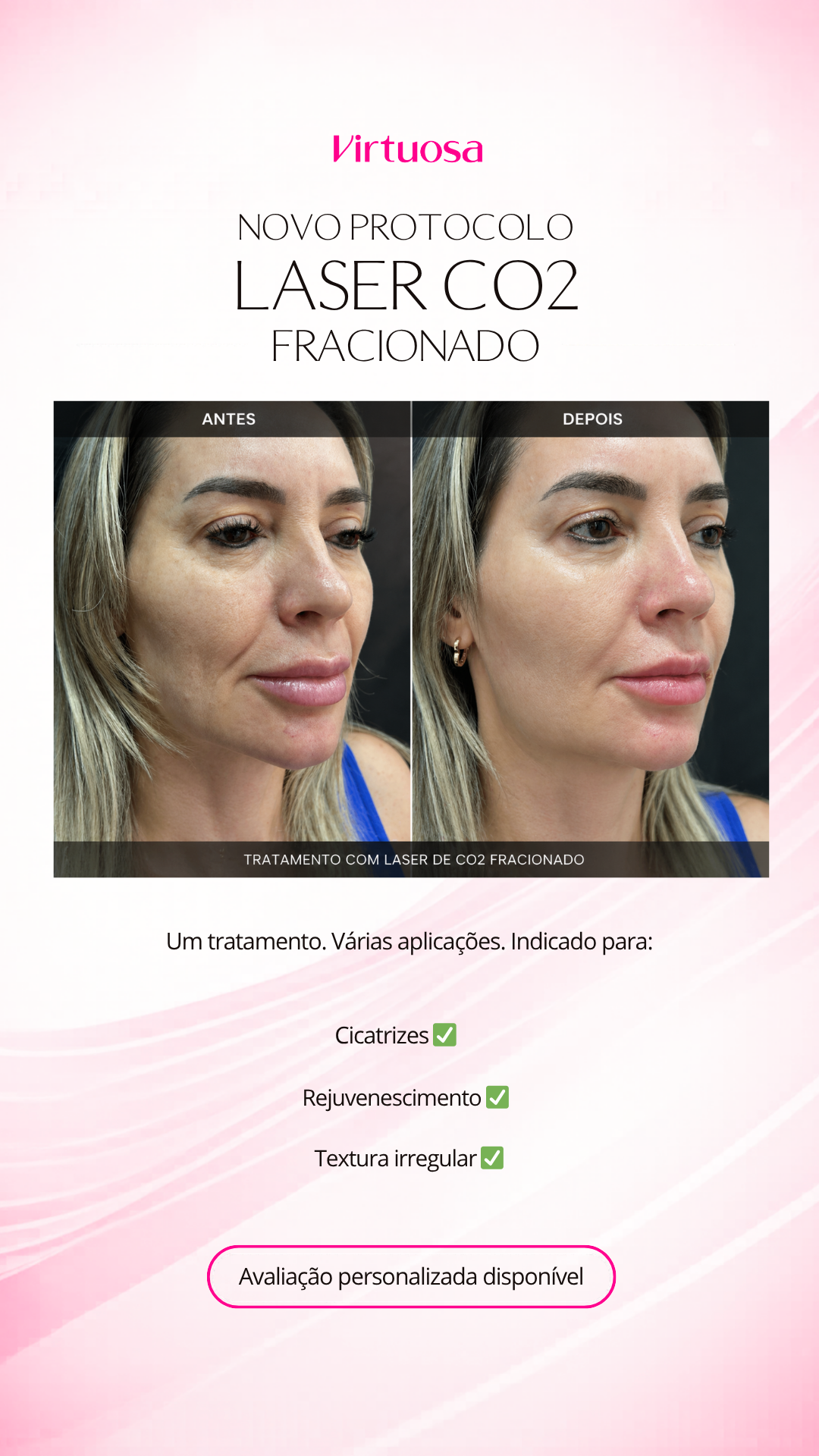Clínica Virtuosa - Brusque Facebook ad from May 20, 2026