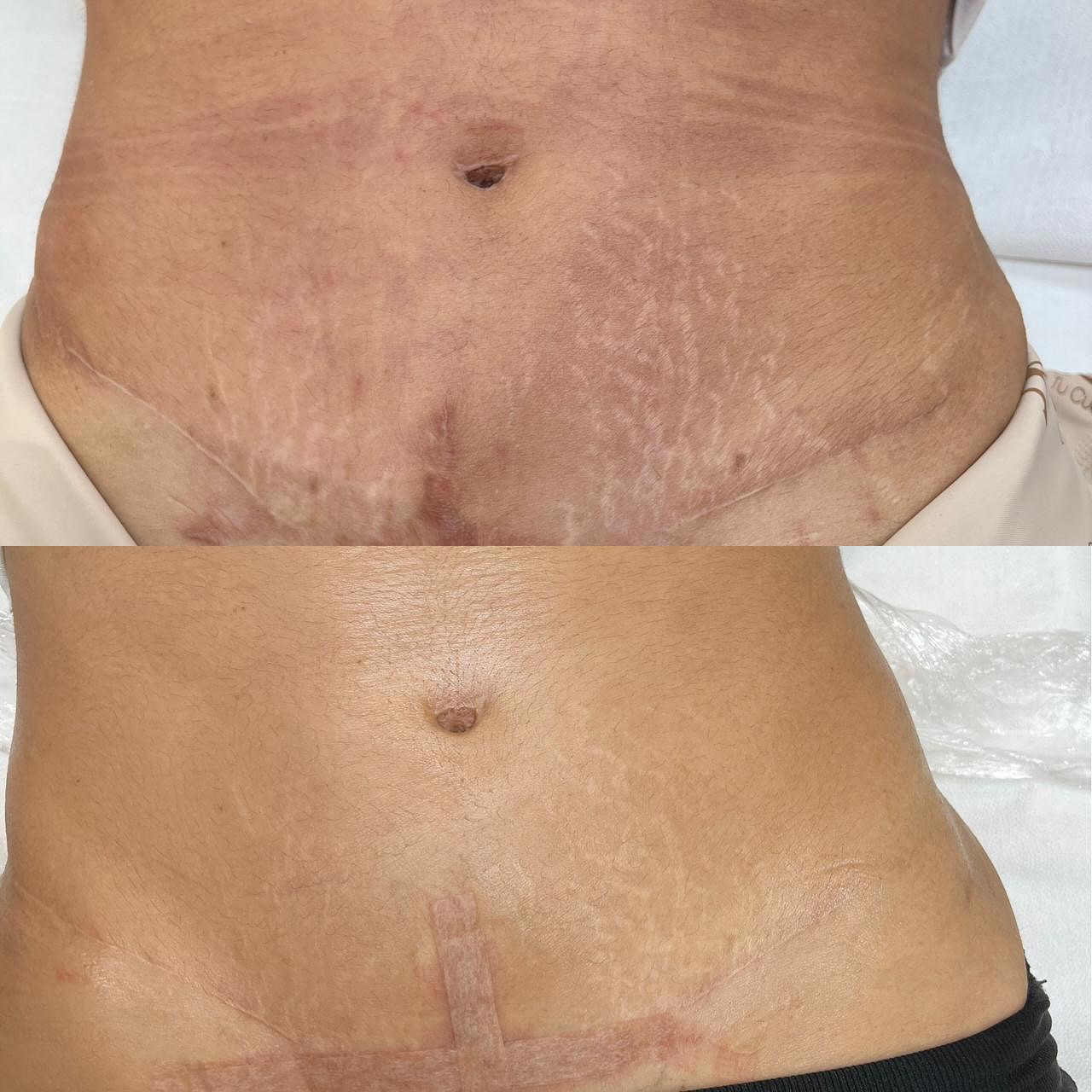 Microblading Facebook ad: ¡Dale a tu piel la uniformidad que prefieres!