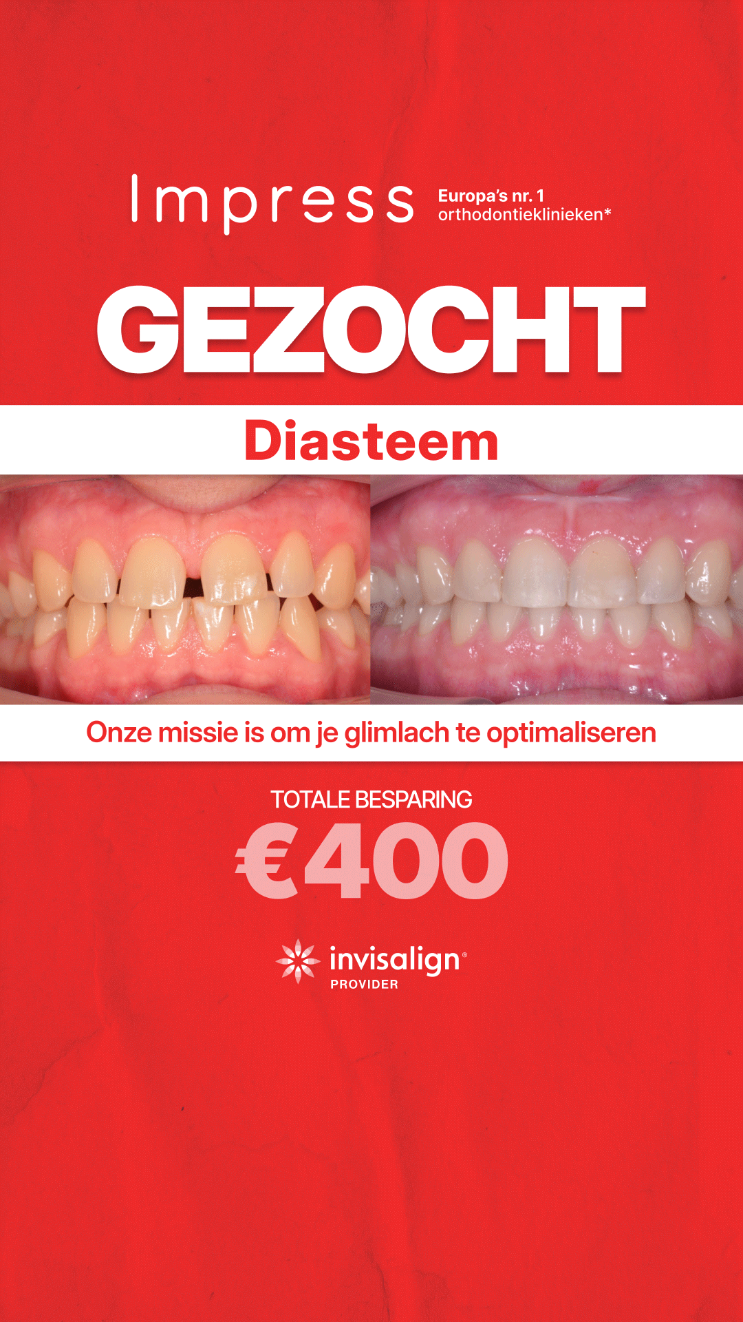 Impress Nederland Aligners Facebook ad