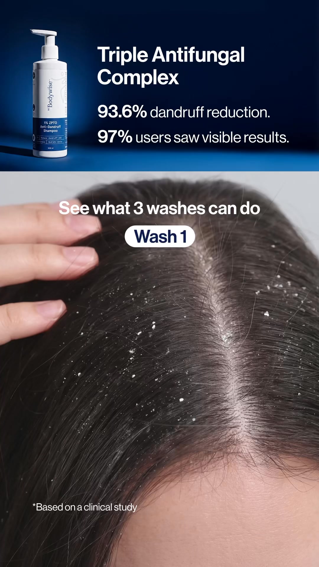 Be Bodywise - UAE Facebook ad: Treat Dandruff at the Root