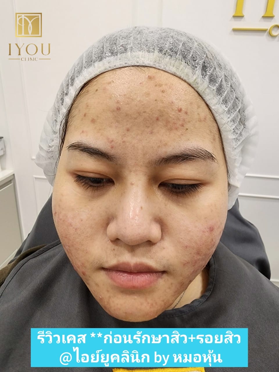 IYOU Clinic ไอย์ยูคลินิก ฉะเชิงเทรา by หมอหุ้น Facebook ad