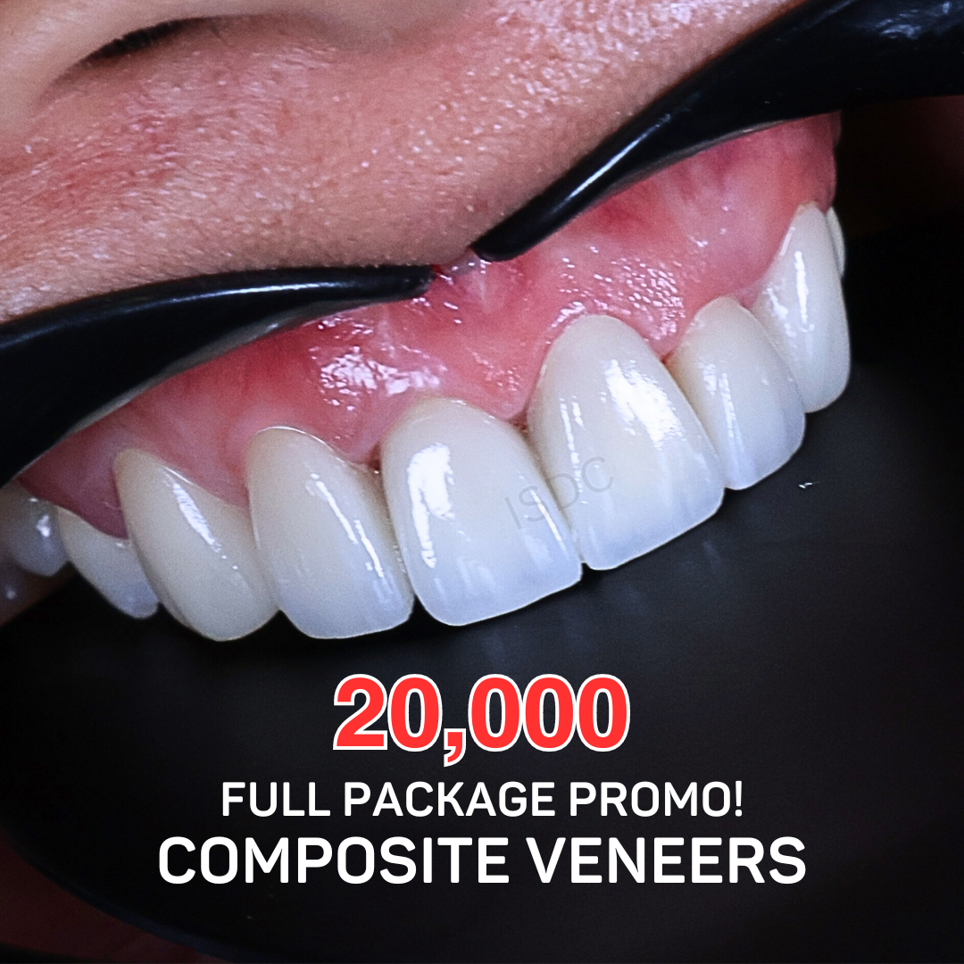 Ivory Smile Dental Clinic - Makati Branch Facebook ad: Chat in Messenger