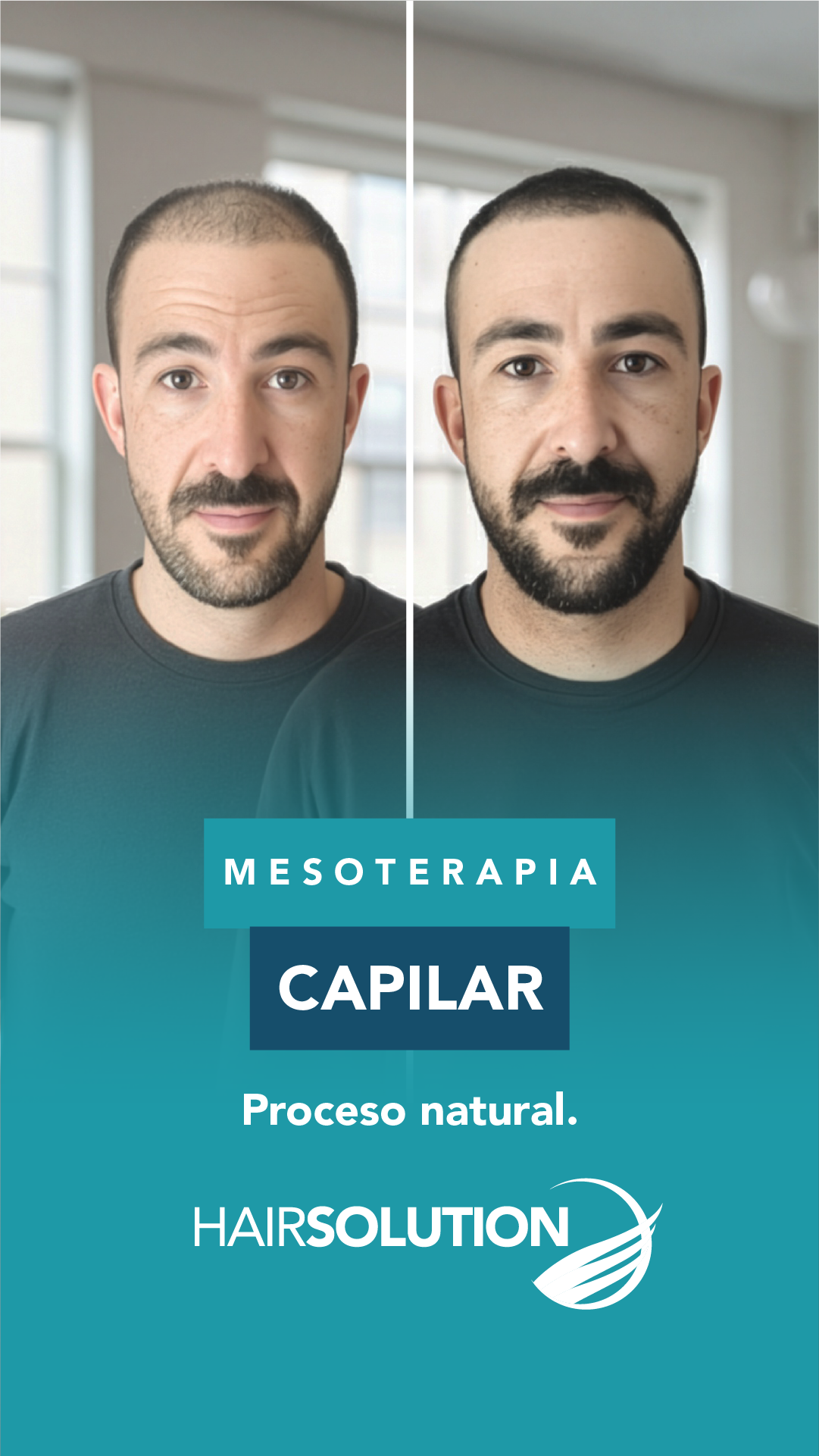 Hair Solution Facebook ad