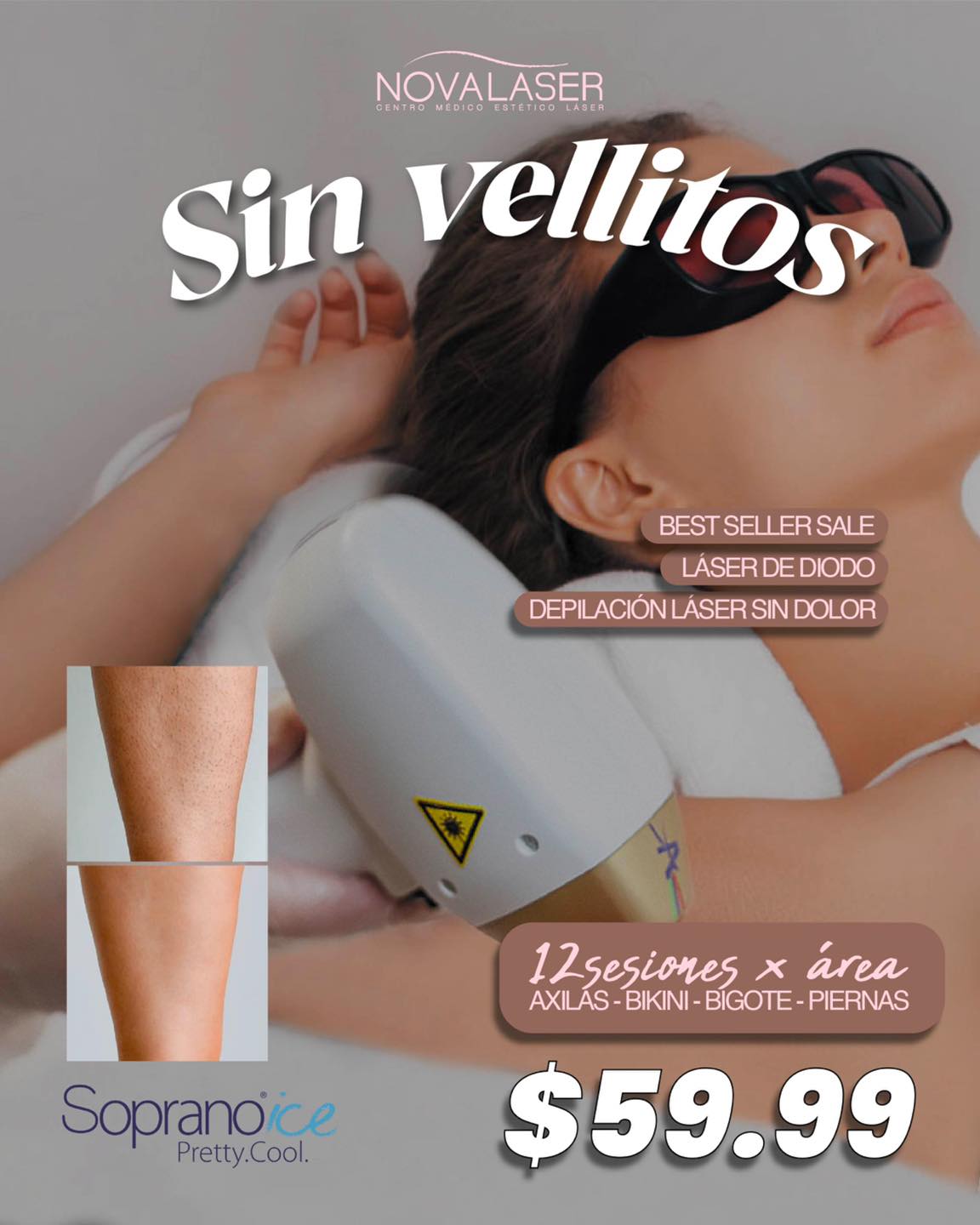 Novalaser ES Facebook ad