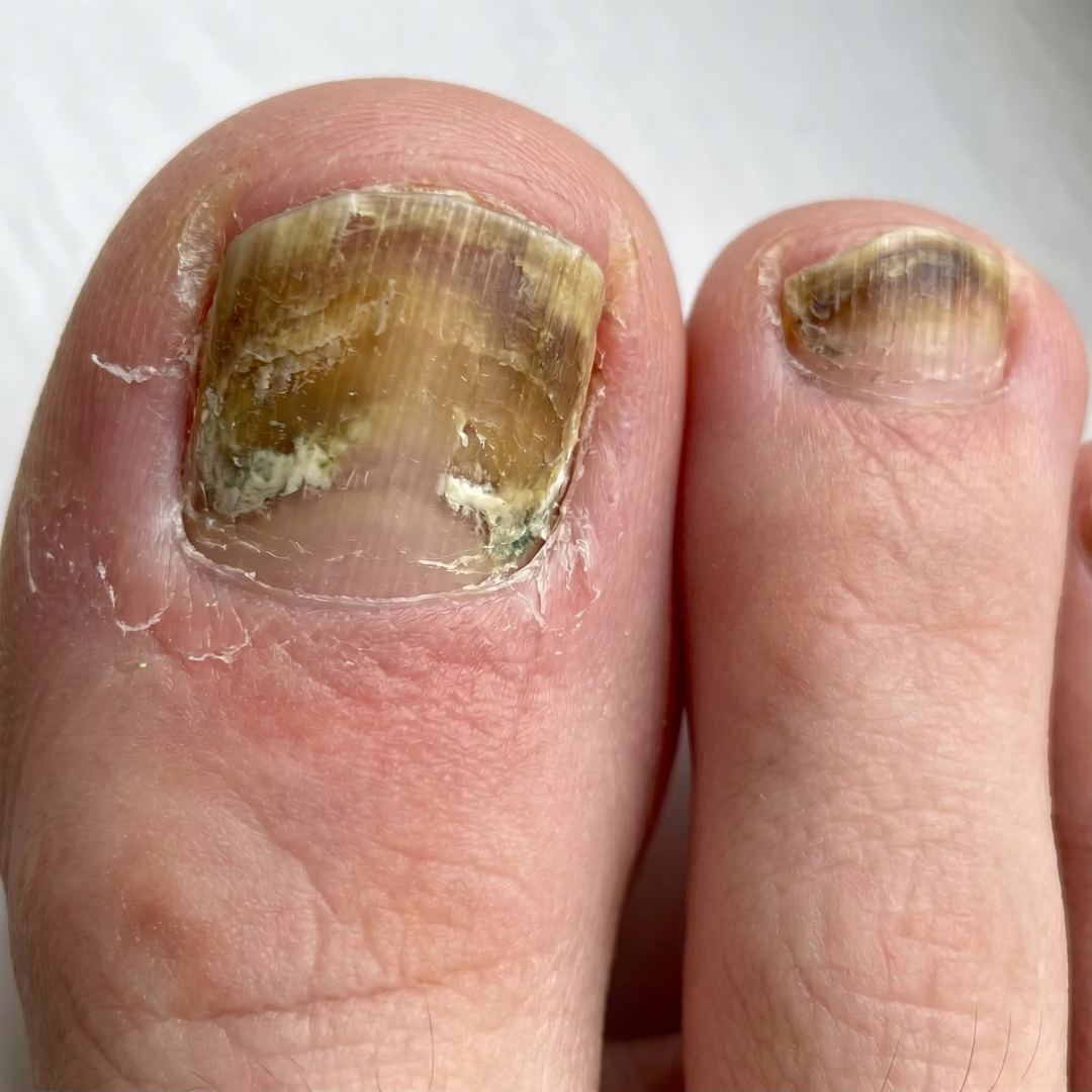 Dr. Jenna Blake, Podiatrist Facebook ad