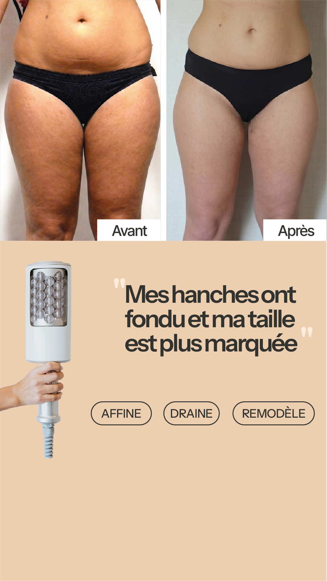 aesthé Facebook ad