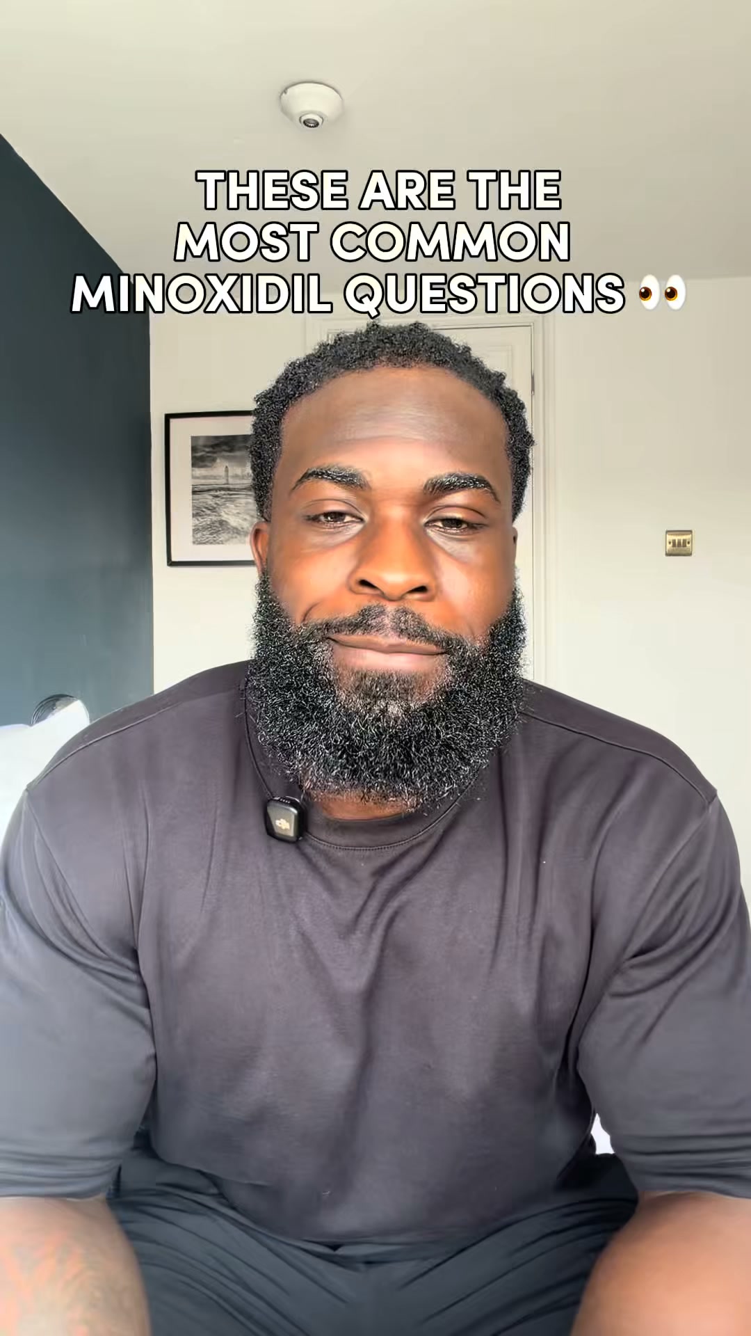 Sons Facebook ad: Your hairline. Your call.