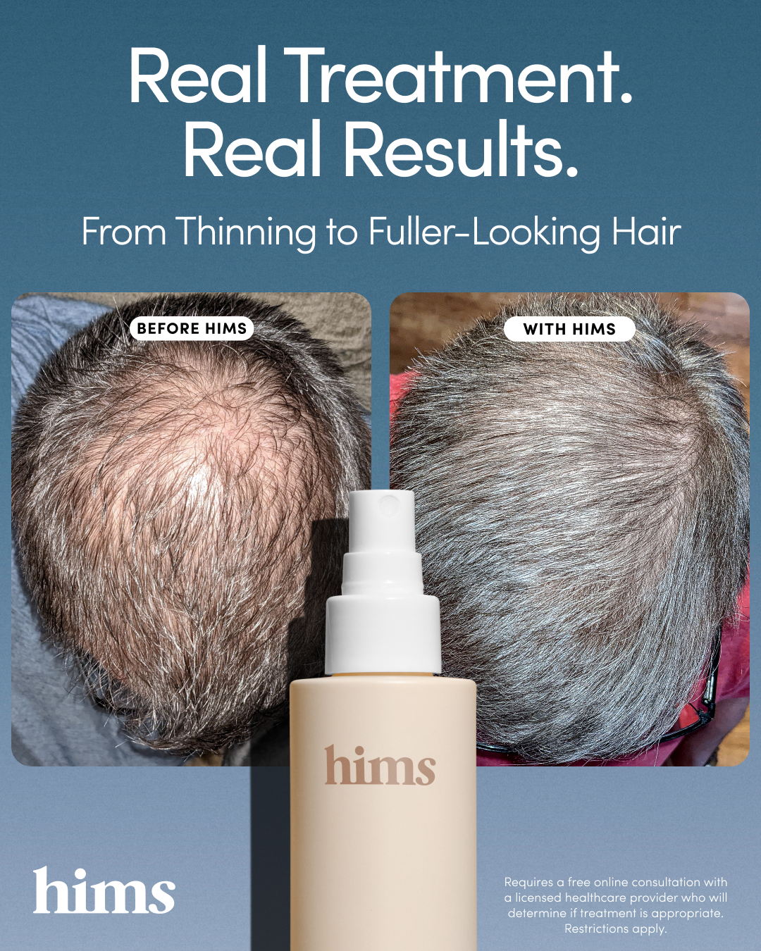 hims Facebook ad