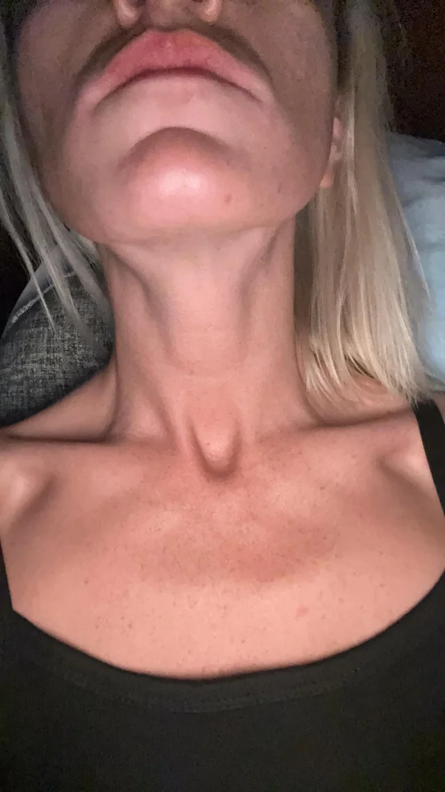 Deborah Ann Whitaker - Nephrologist Facebook ad