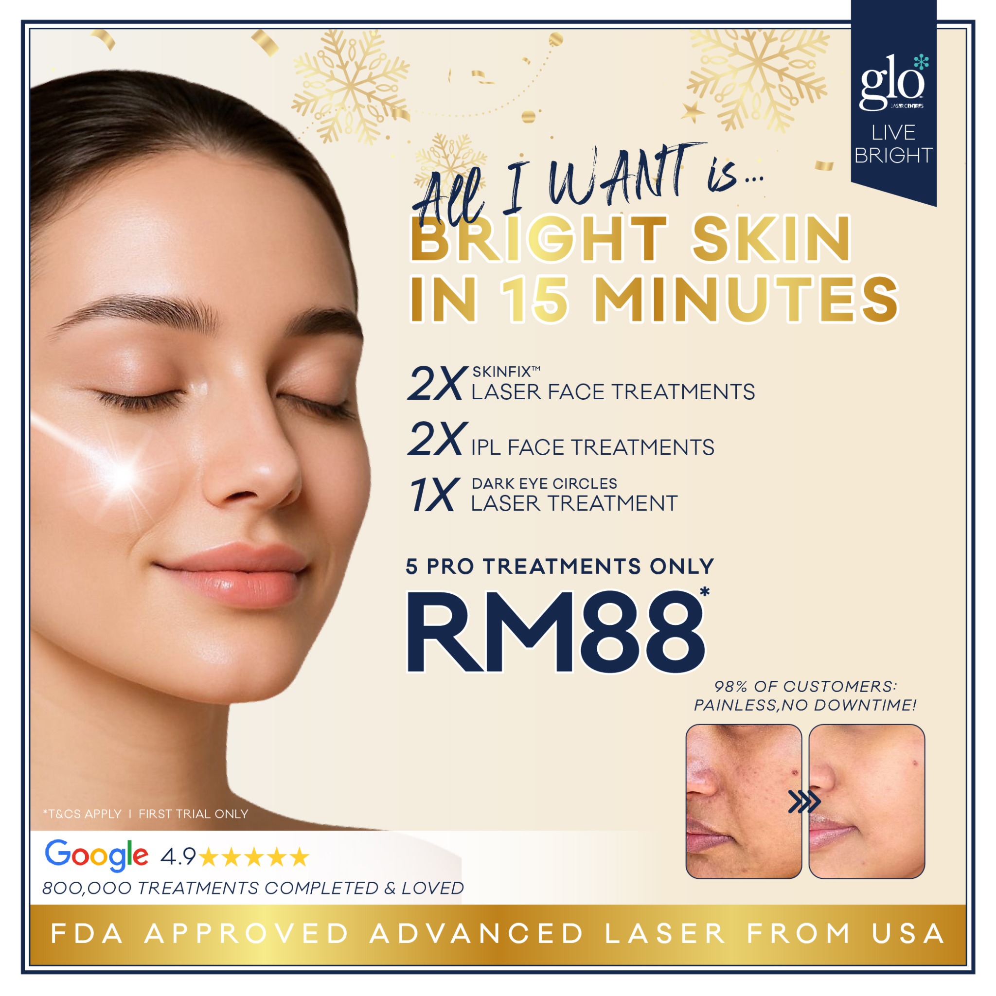 Glo Laser Centres Facebook ad: RM88 glow guarantee