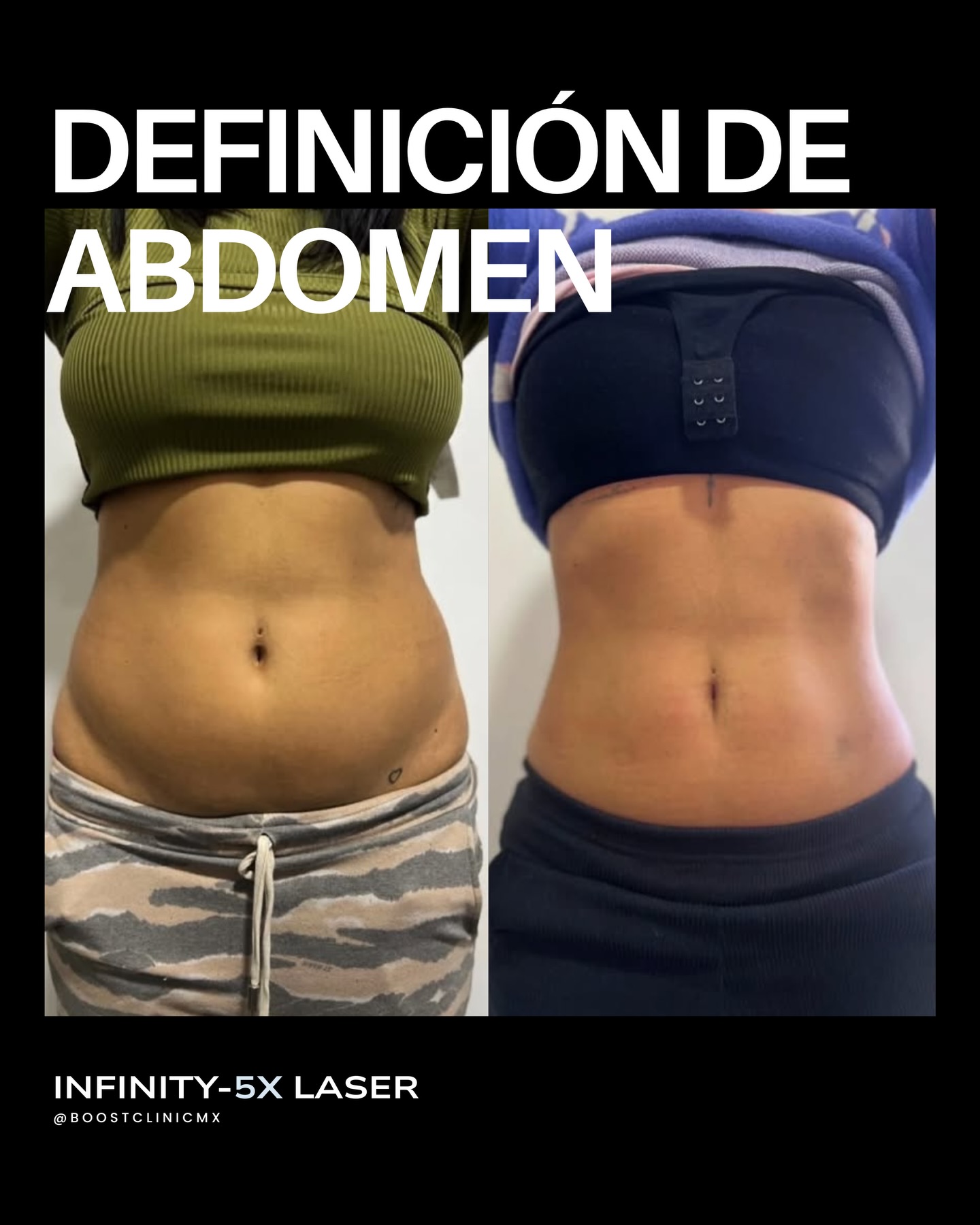 Boost Clinic Facebook ad