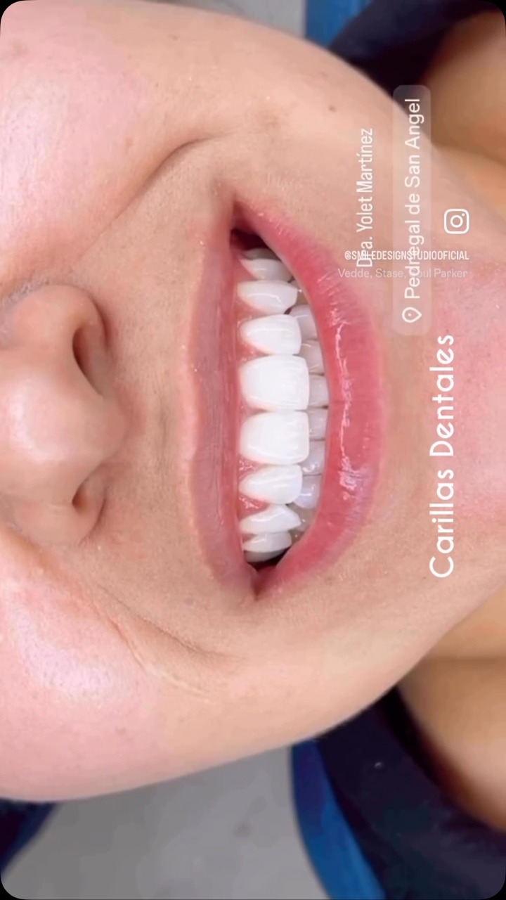 smiledesignstudiooficial Facebook ad: La mejor sonrisa solo en Smile Design Studio