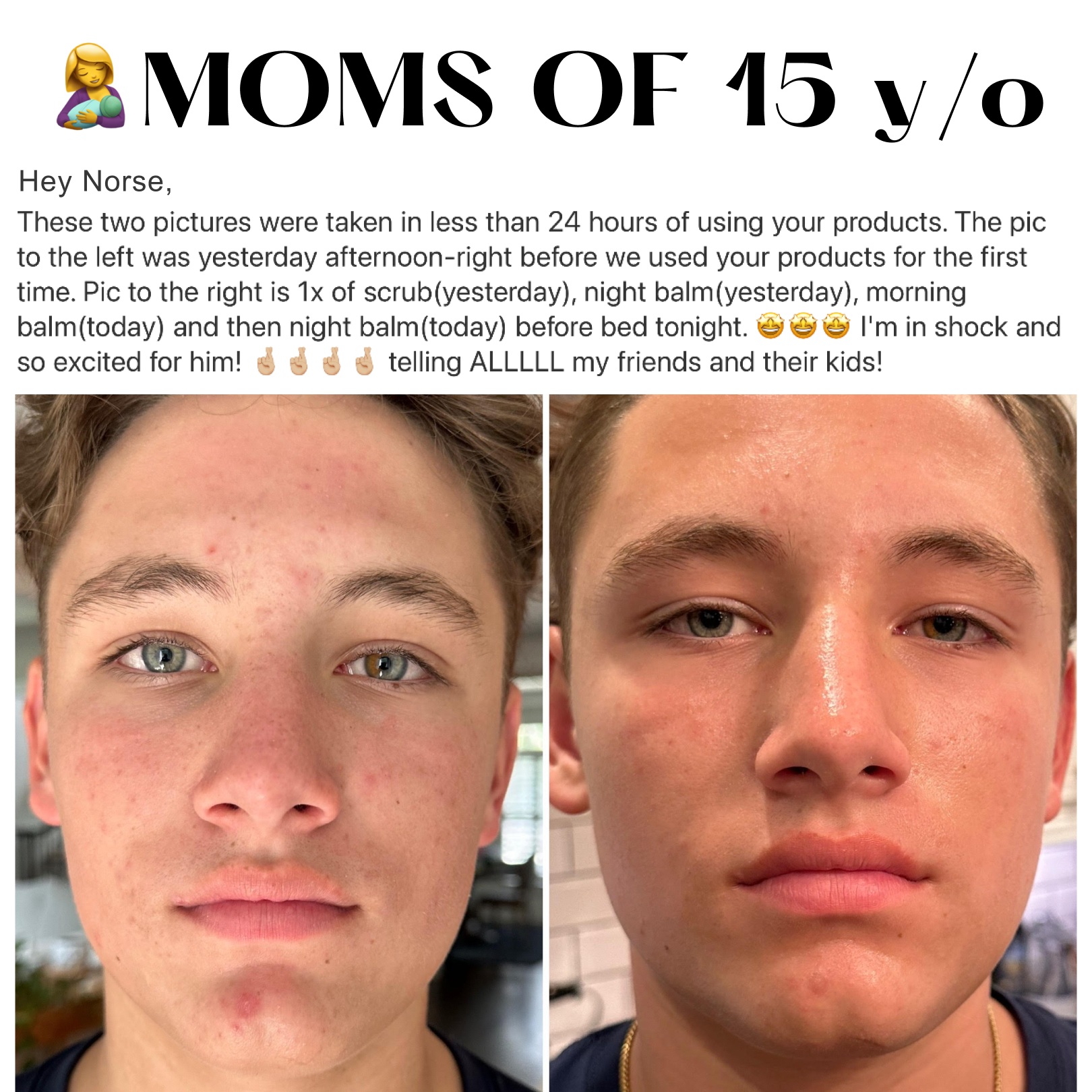 Anne's Skincare Blog Facebook ad