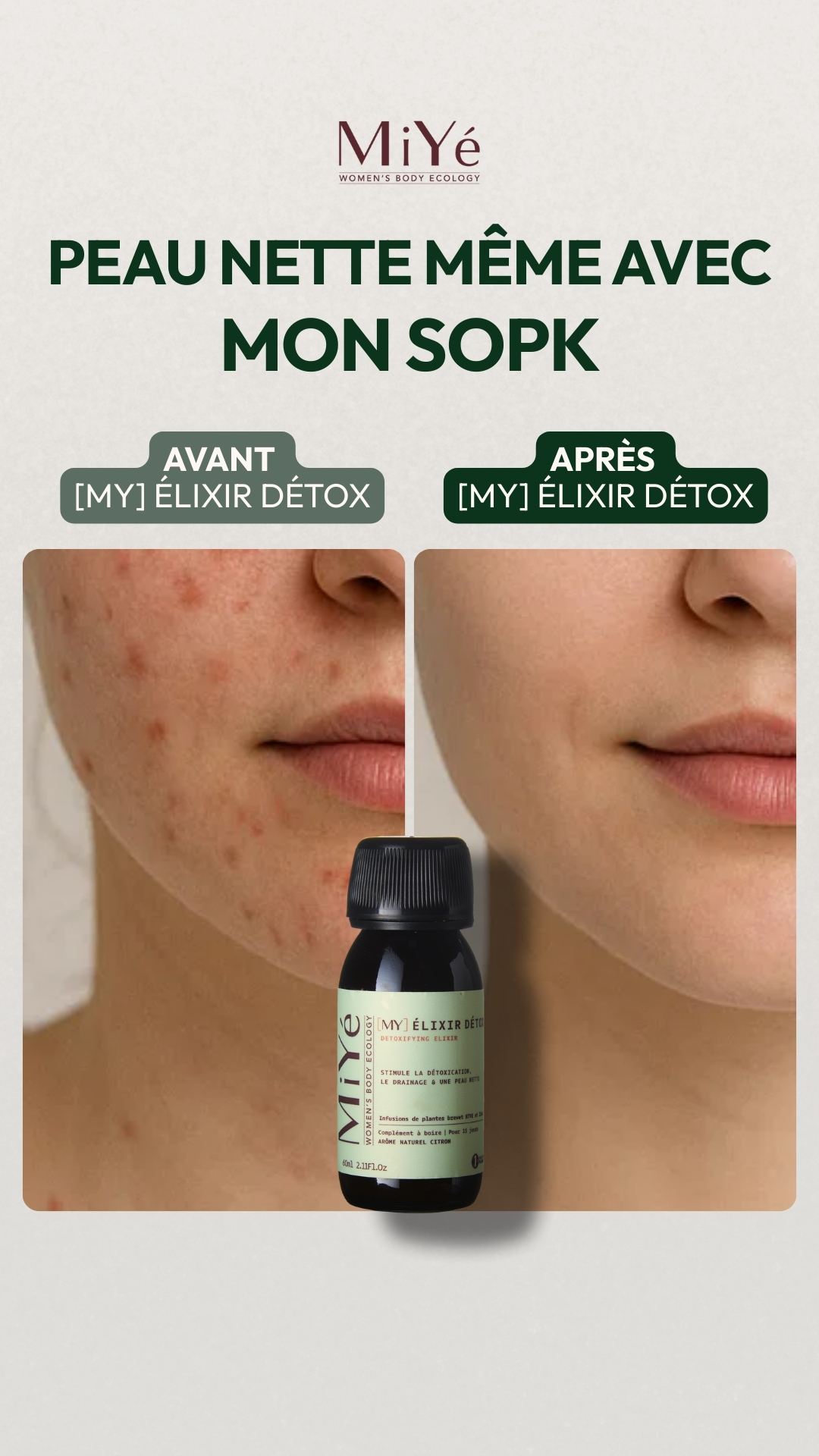 MiYé Facebook ad