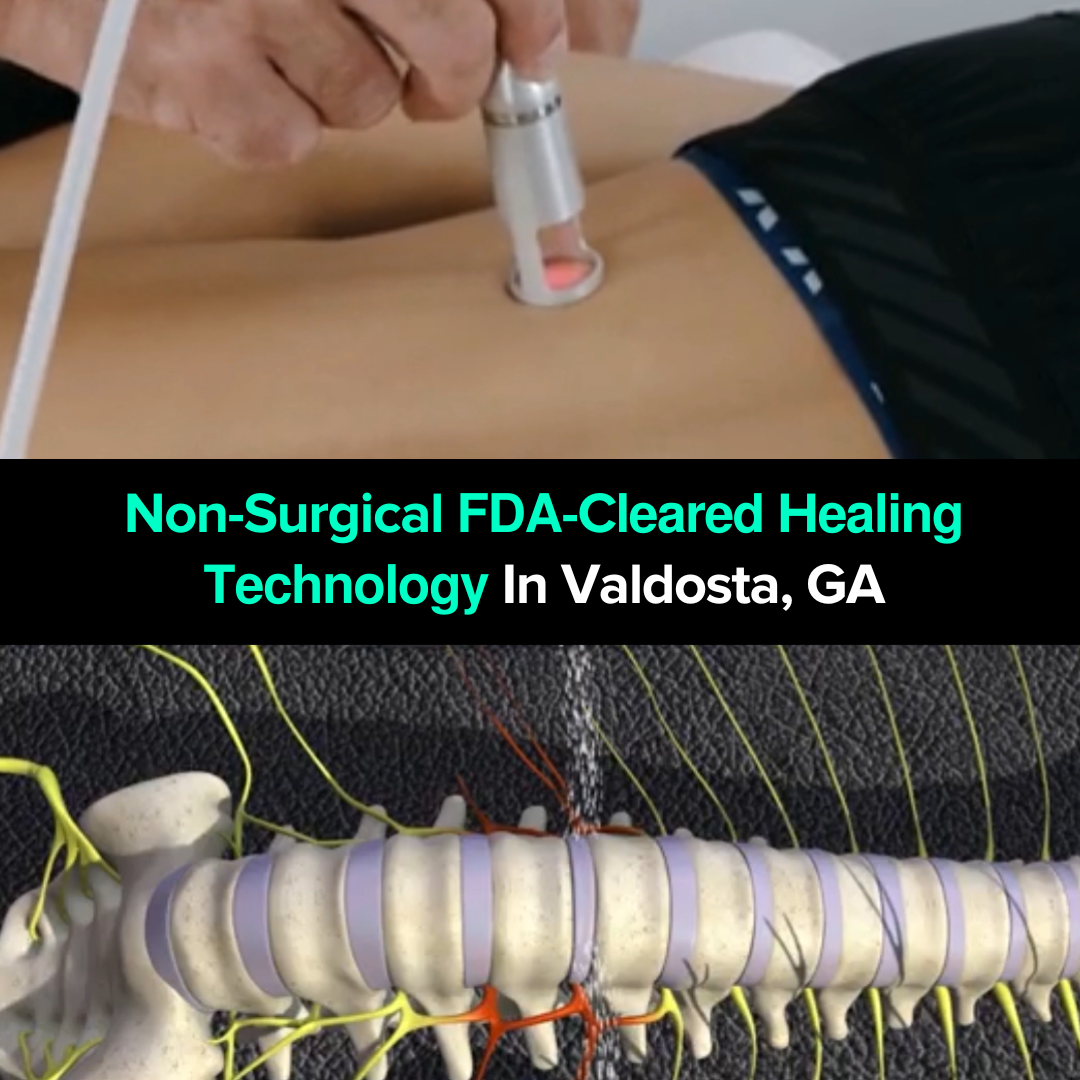 Valdosta Disc Center Facebook ad: Disc Rehydration Breakthrough
